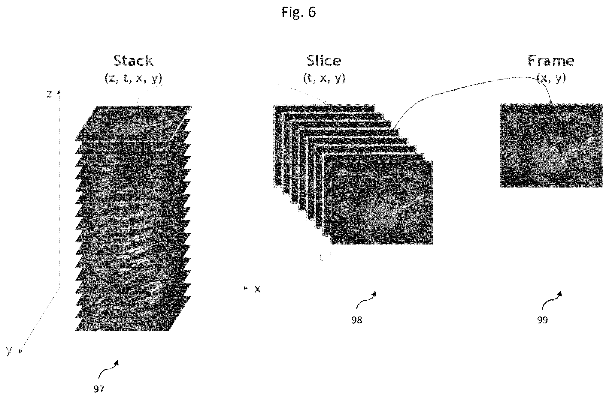 Patent US11836921 Figure 6 – Artificial-intelligence-based global cardiac motion classification