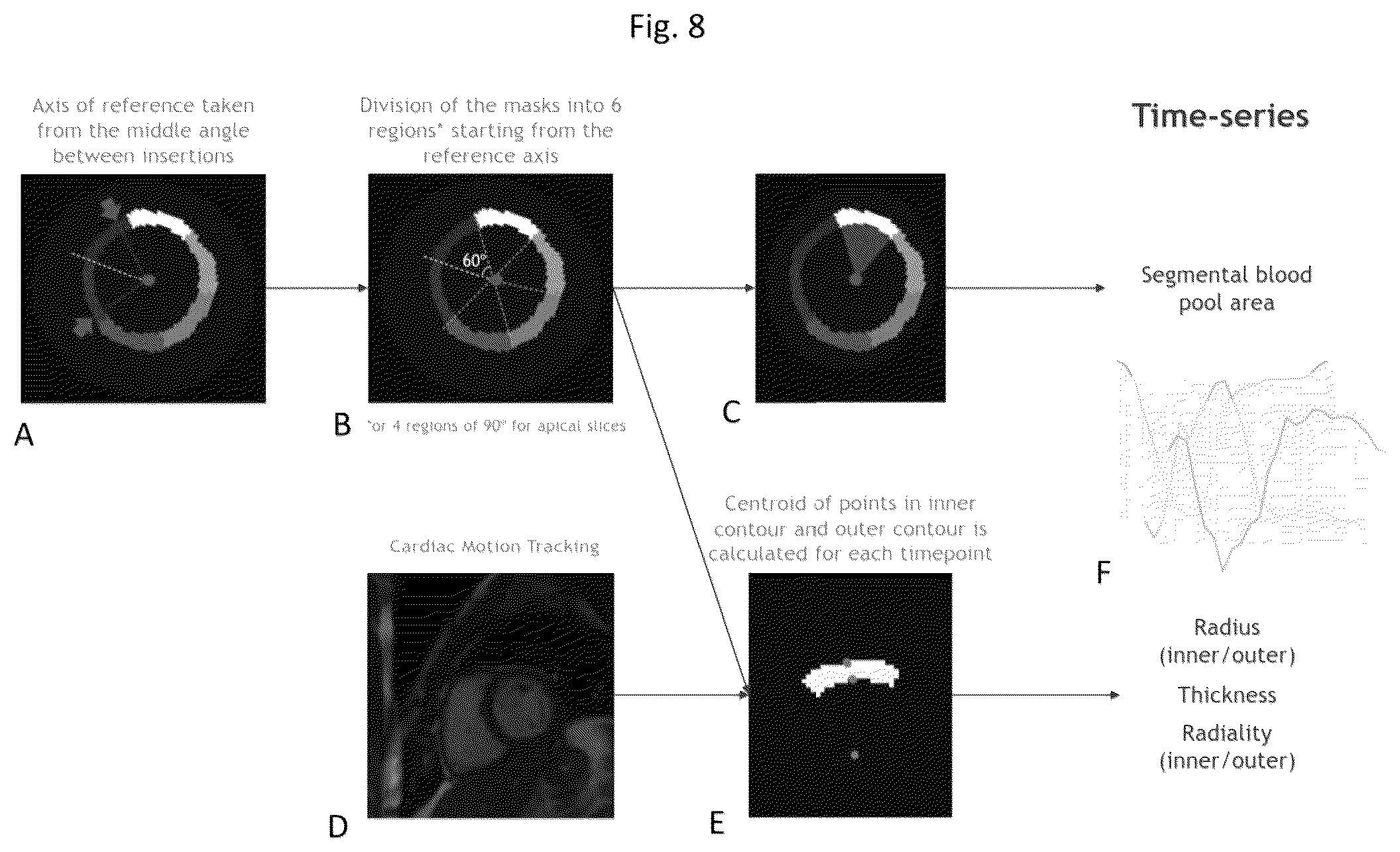 Patent US11836921 Figure 8 – Artificial-intelligence-based global cardiac motion classification