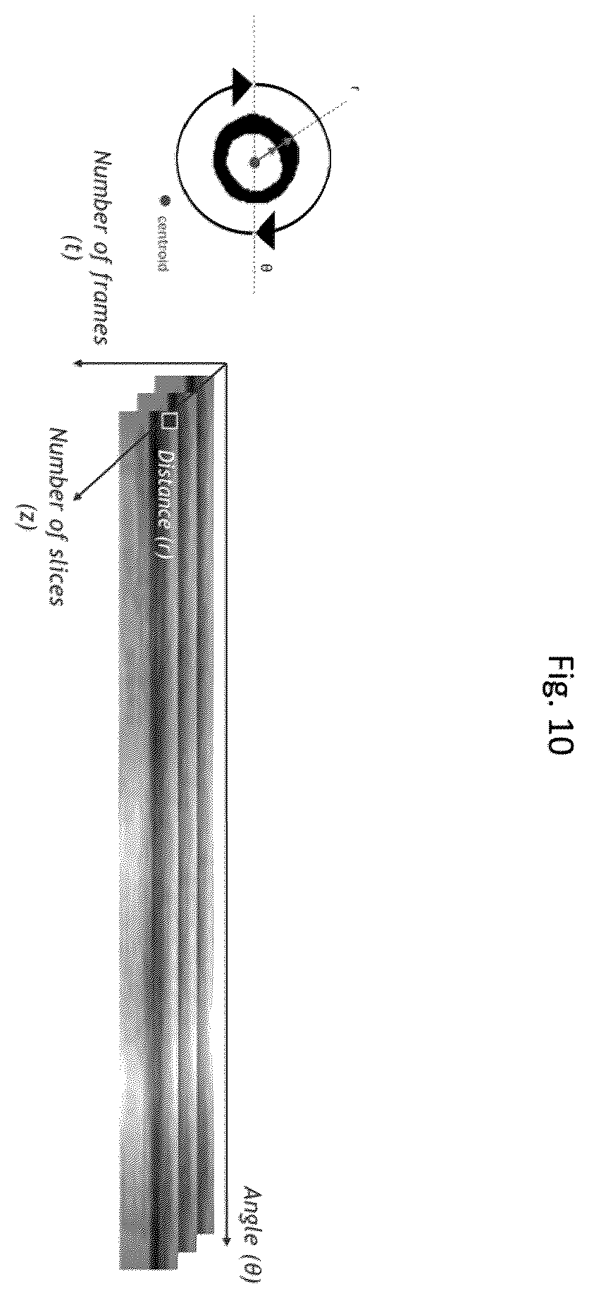 Patent US11836921 Figure 10 – Artificial-intelligence-based global cardiac motion classification