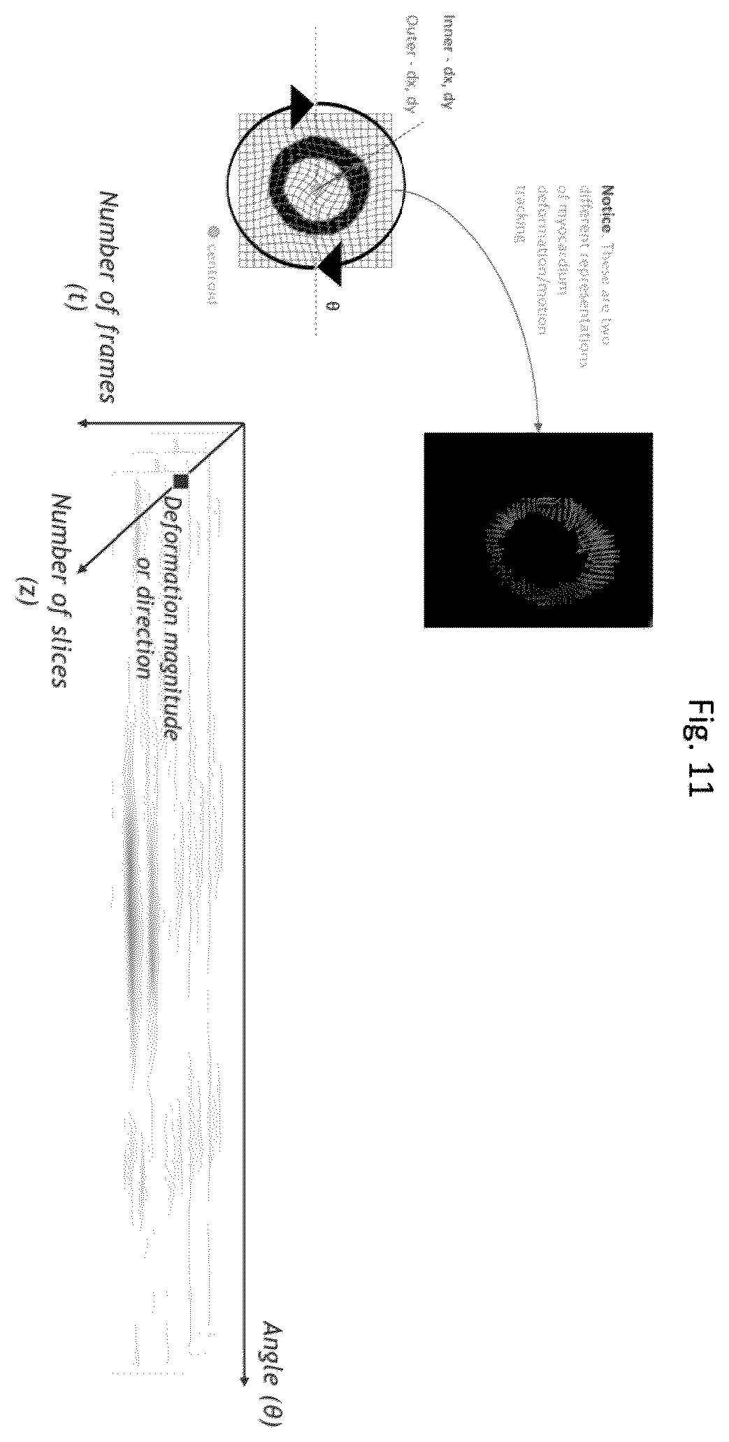 Patent US11836921 Figure 11 – Artificial-intelligence-based global cardiac motion classification