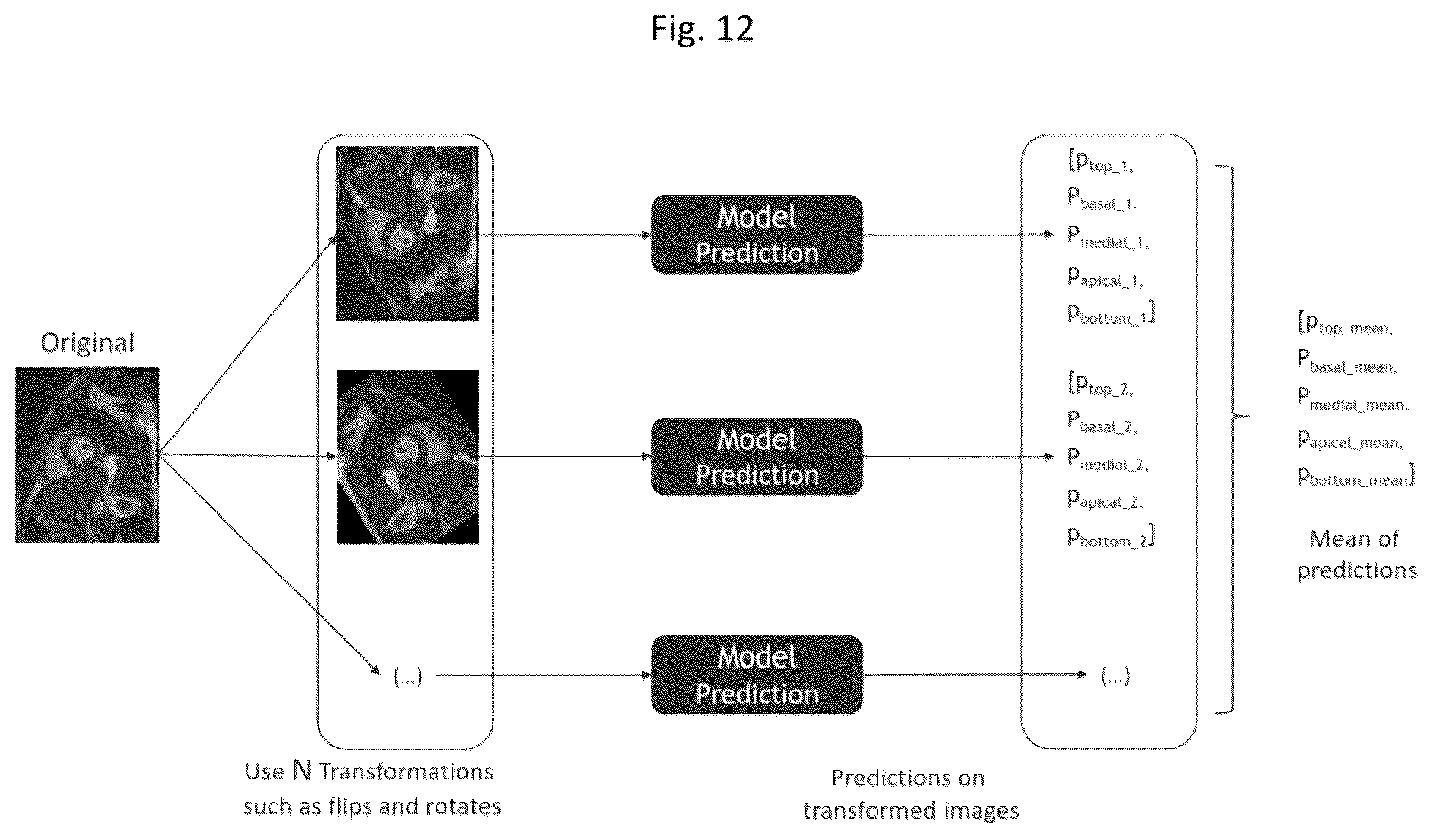 Patent US11836921 Figure 12 – Artificial-intelligence-based global cardiac motion classification