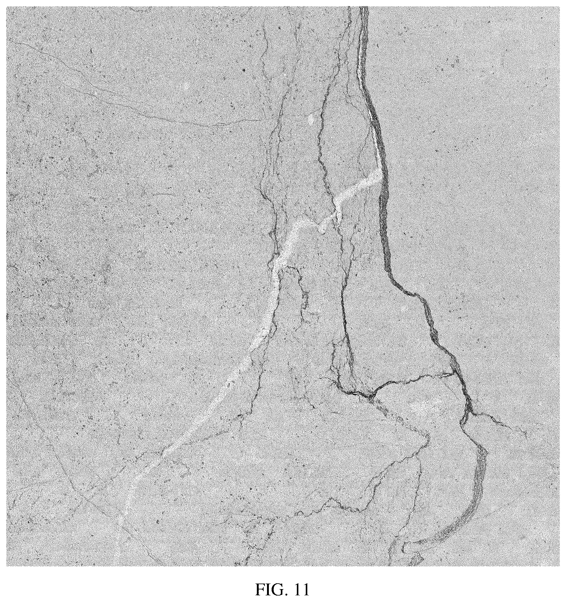Patent US11841355 Figure 11 – Intelligent quantitative microscopic identification system and intelligent identification method for whole rock polished sections
