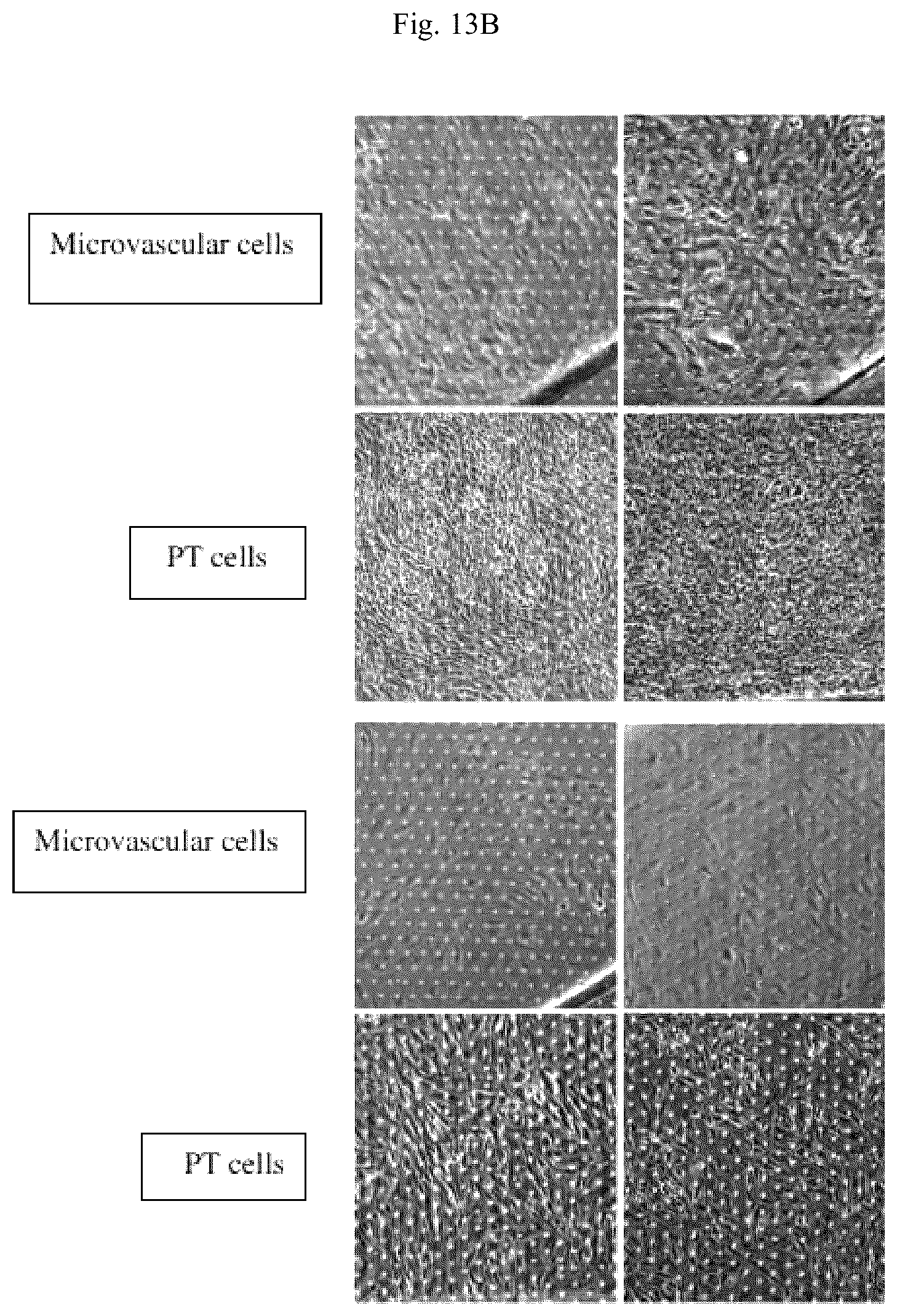 Patent US11841361 Figure 18 – Microfluidic proximal tubule kidney-on-chip
