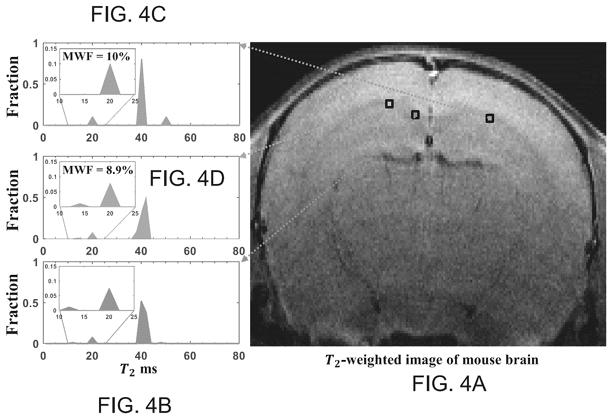 Patent US11841410 Figure 4 – Method and system for analyzing multi-component magnetic resonance signals