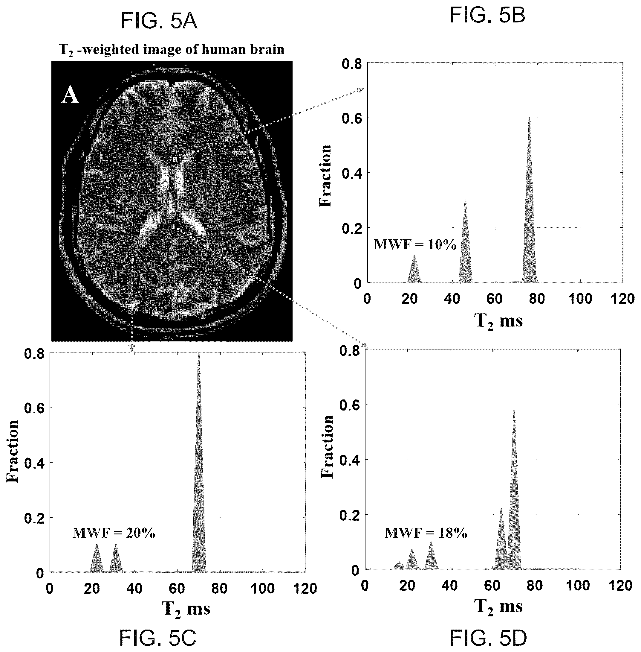 Patent US11841410 Figure 5 – Method and system for analyzing multi-component magnetic resonance signals