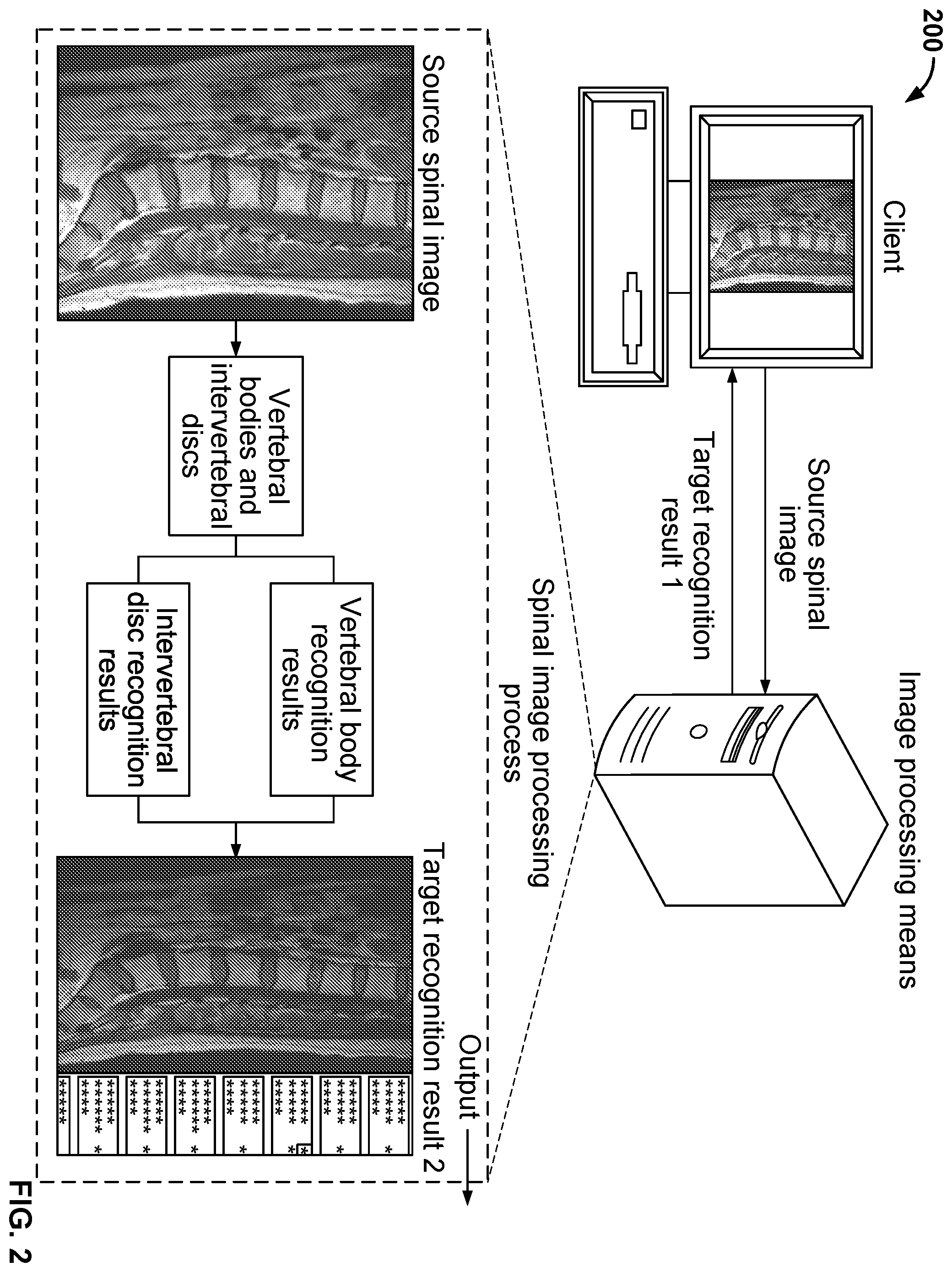 Patent US11841923 Figure 2 – Processing method, model training method, means, and storage medium for spinal images
