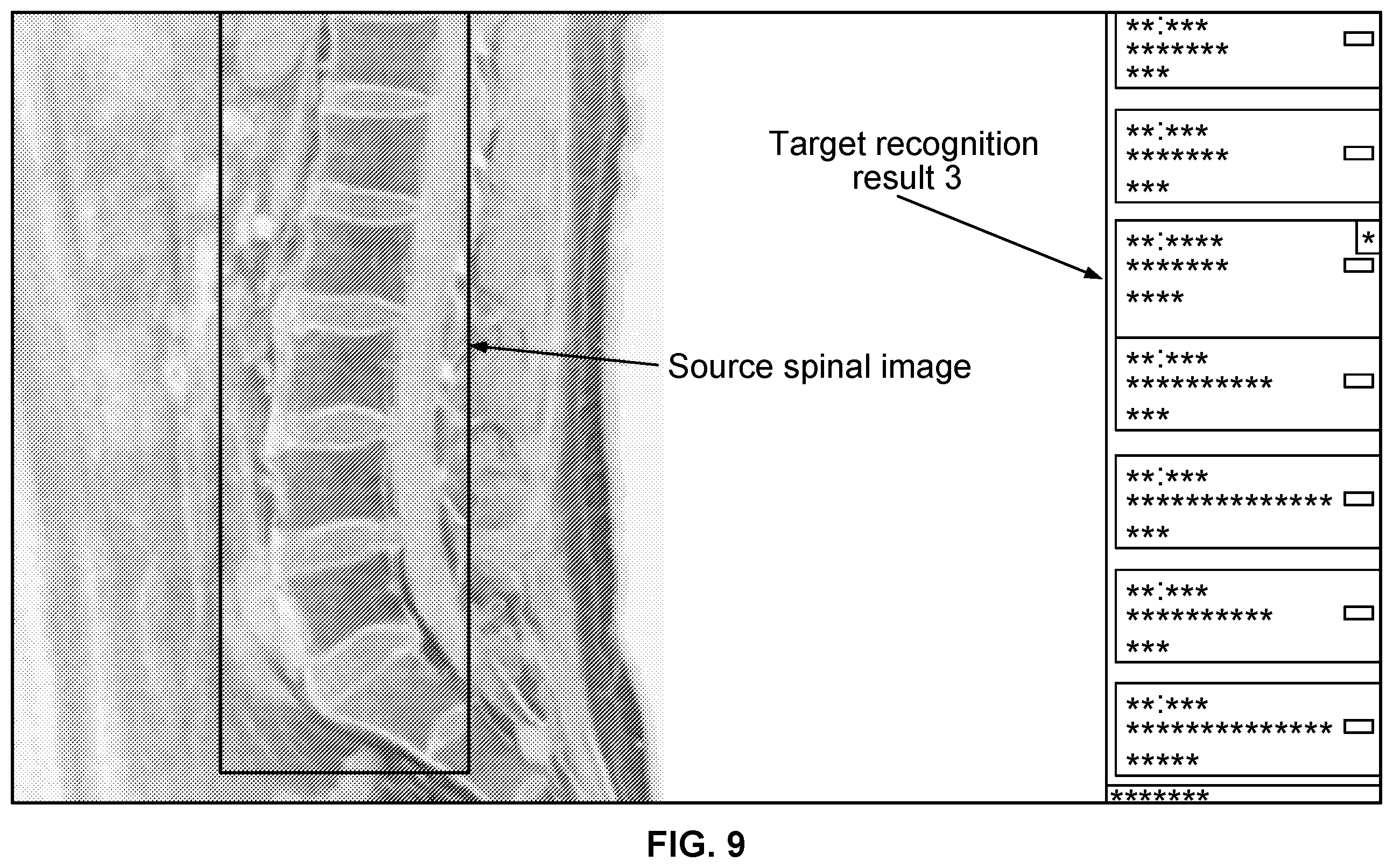 Patent US11841923 Figure 9 – Processing method, model training method, means, and storage medium for spinal images