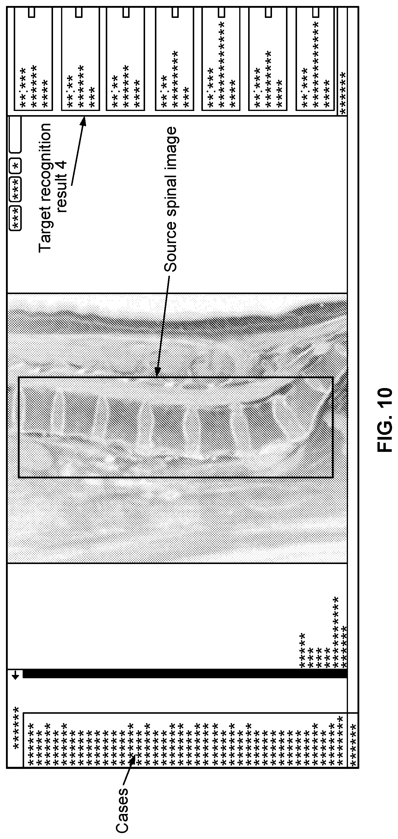 Patent US11841923 Figure 10 – Processing method, model training method, means, and storage medium for spinal images