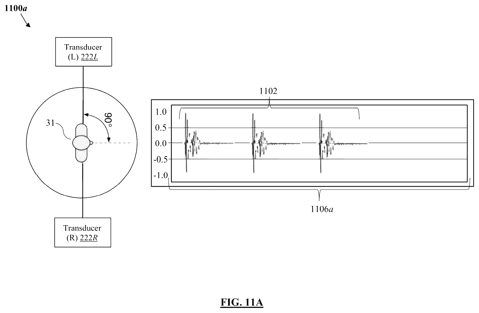 Patent US11847379 Figure 11 – Audio processing method and system for environmental enrichment therapy