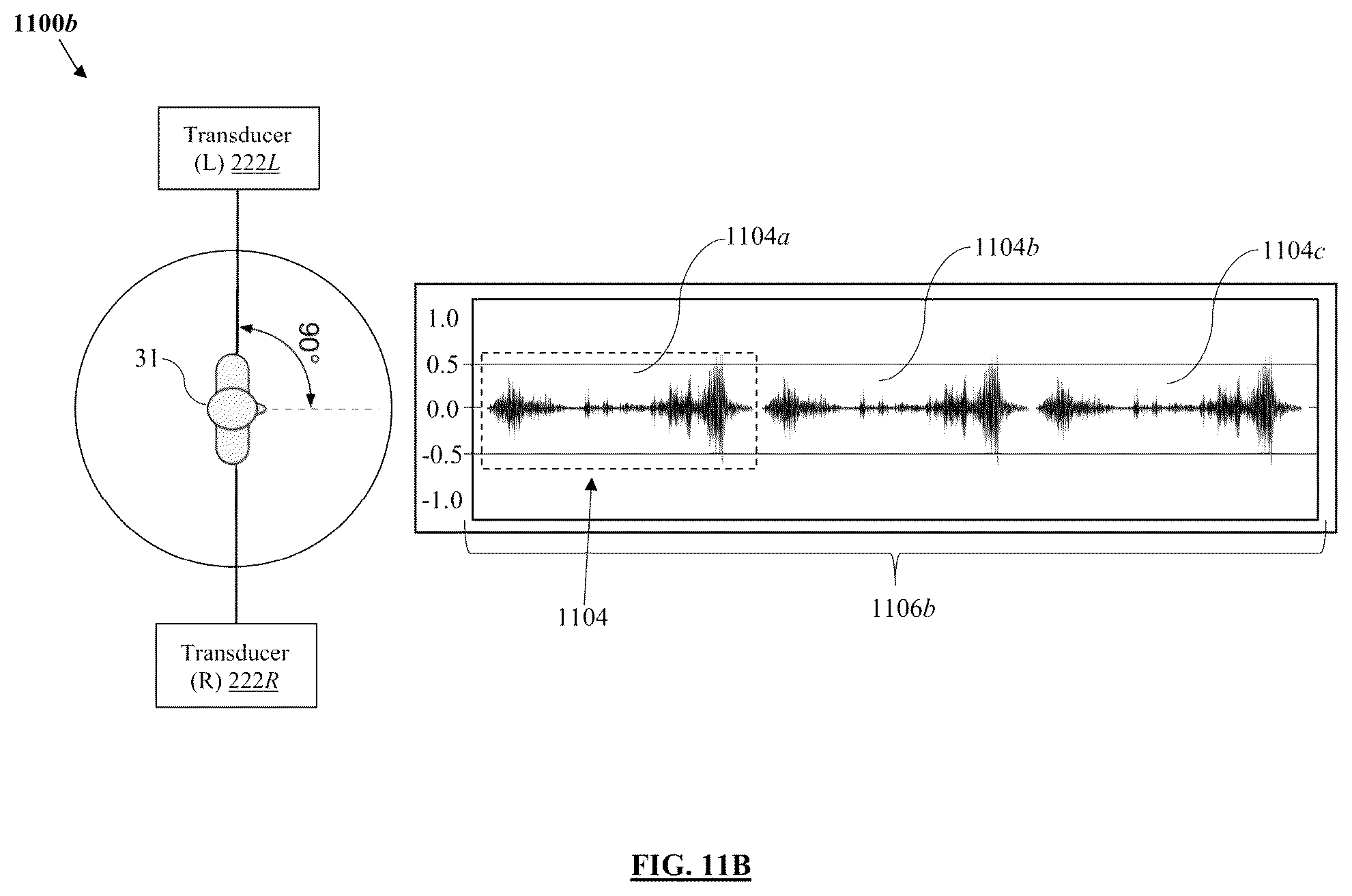 Patent US11847379 Figure 12 – Audio processing method and system for environmental enrichment therapy