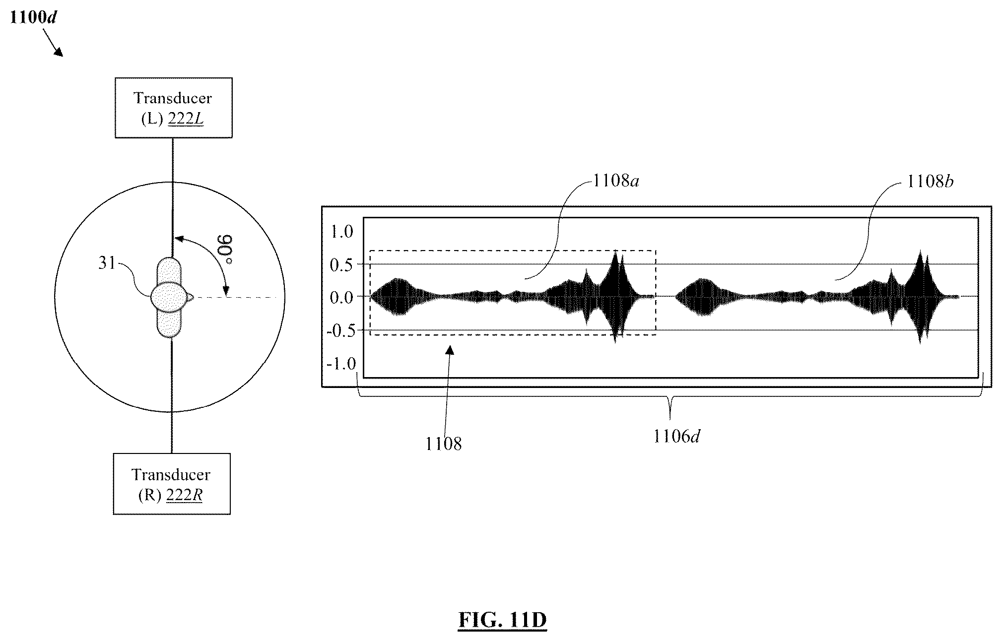 Patent US11847379 Figure 14 – Audio processing method and system for environmental enrichment therapy