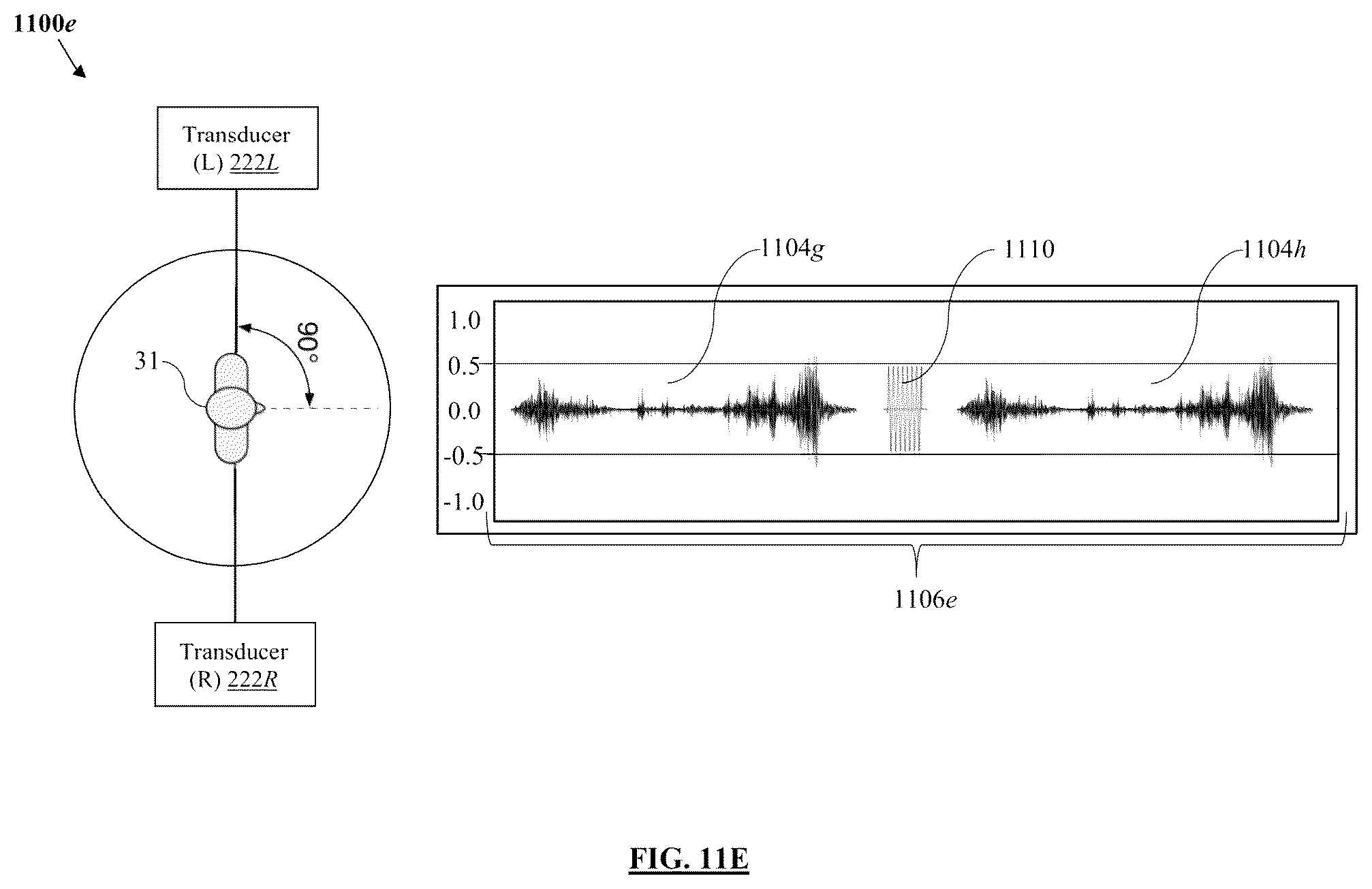 Patent US11847379 Figure 15 – Audio processing method and system for environmental enrichment therapy