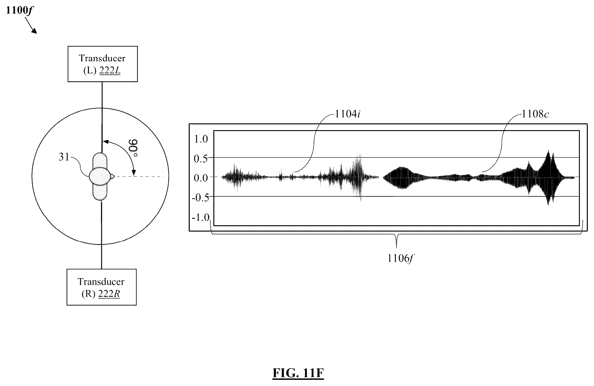 Patent US11847379 Figure 16 – Audio processing method and system for environmental enrichment therapy