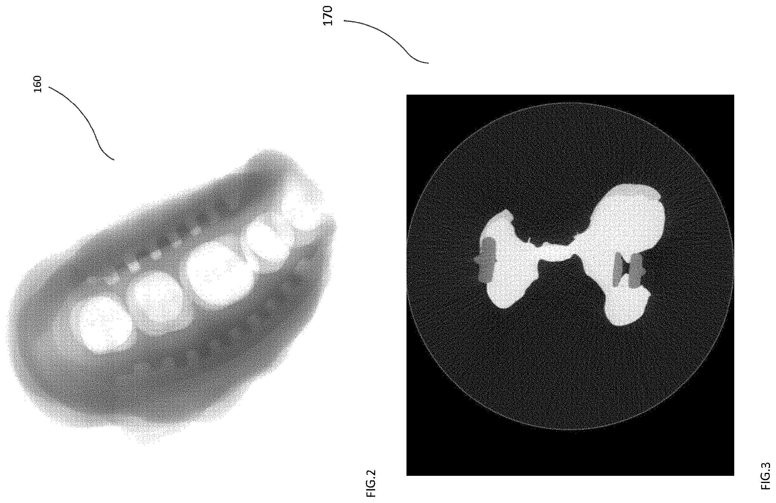 Patent US11847722 Figure 2 – Out of view CT scan reconstruction