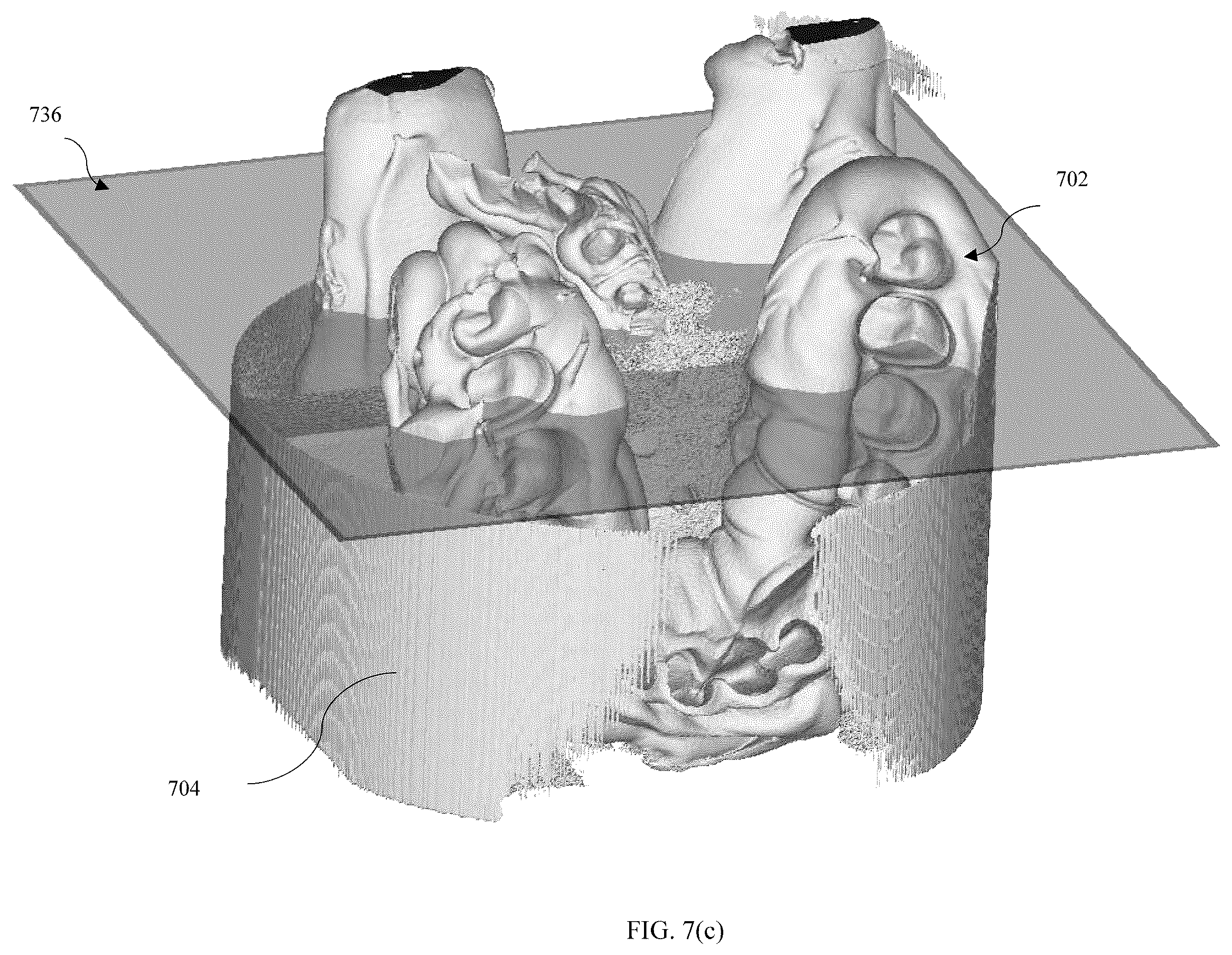 Patent US11847722 Figure 10 – Out of view CT scan reconstruction
