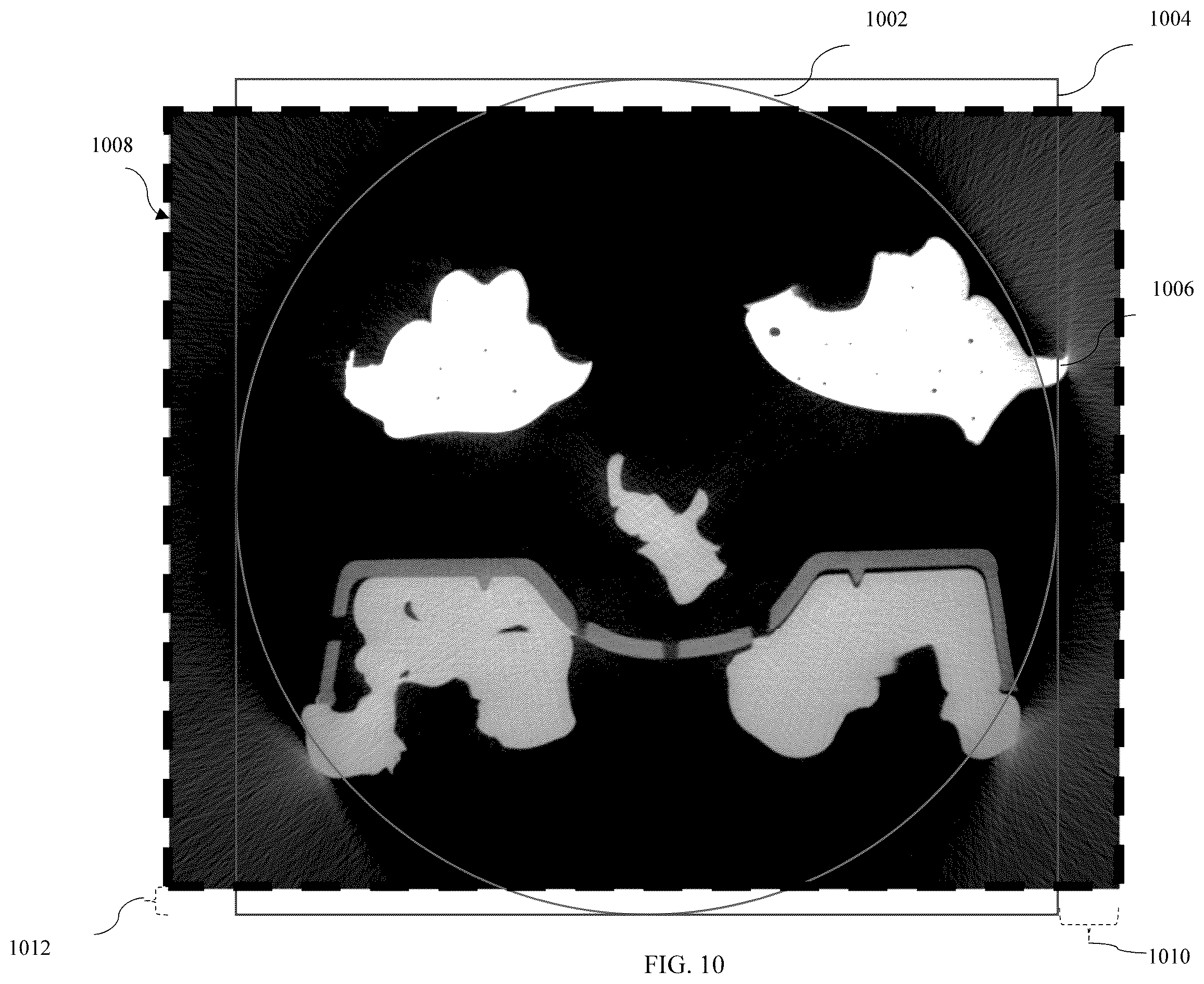 Patent US11847722 Figure 15 – Out of view CT scan reconstruction