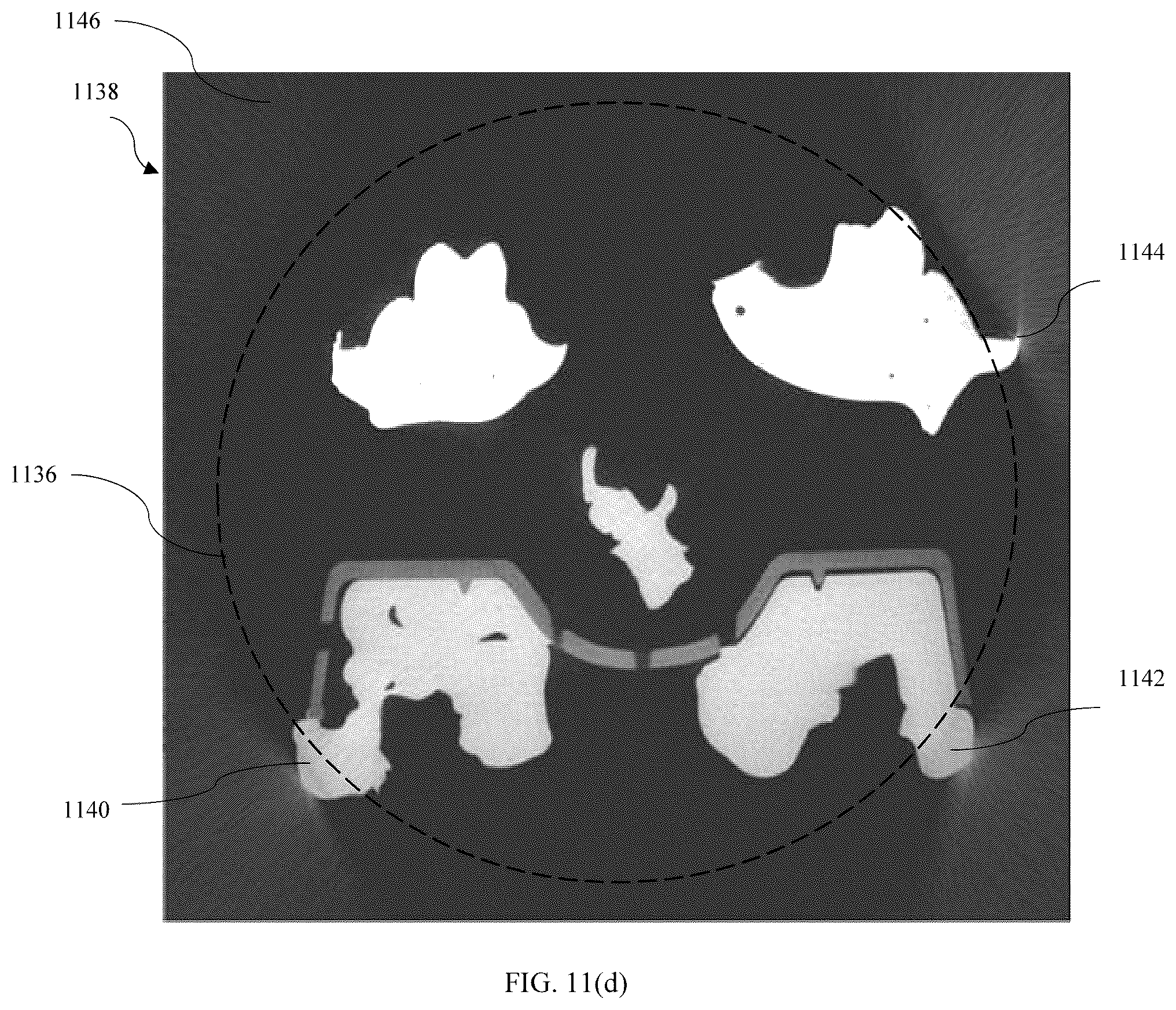 Patent US11847722 Figure 19 – Out of view CT scan reconstruction