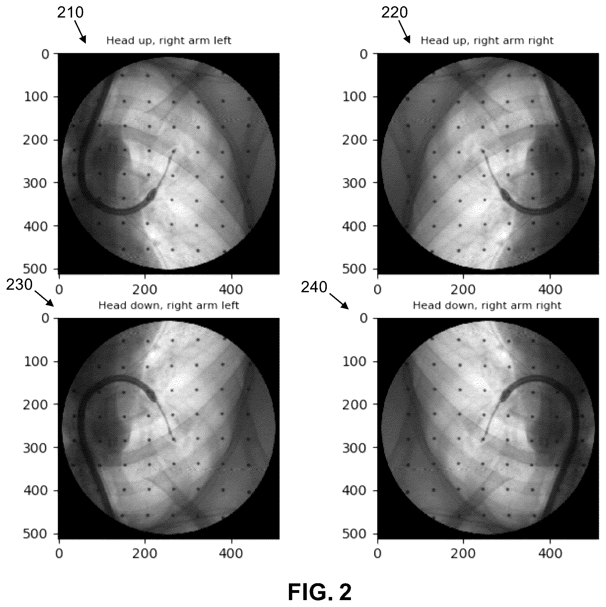 Patent US11847730 Figure 2 – Orientation detection in fluoroscopic images