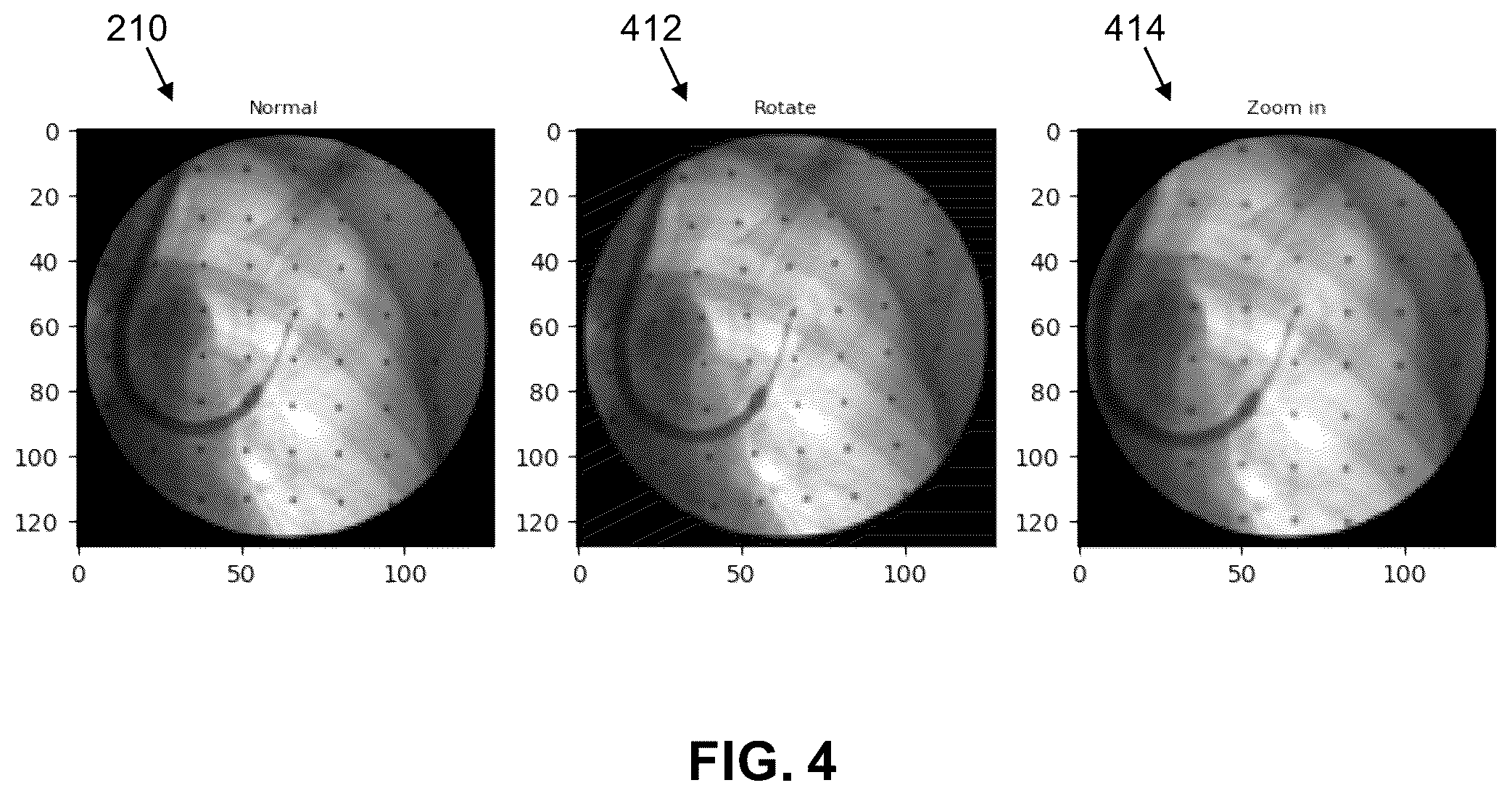 Patent US11847730 Figure 4 – Orientation detection in fluoroscopic images