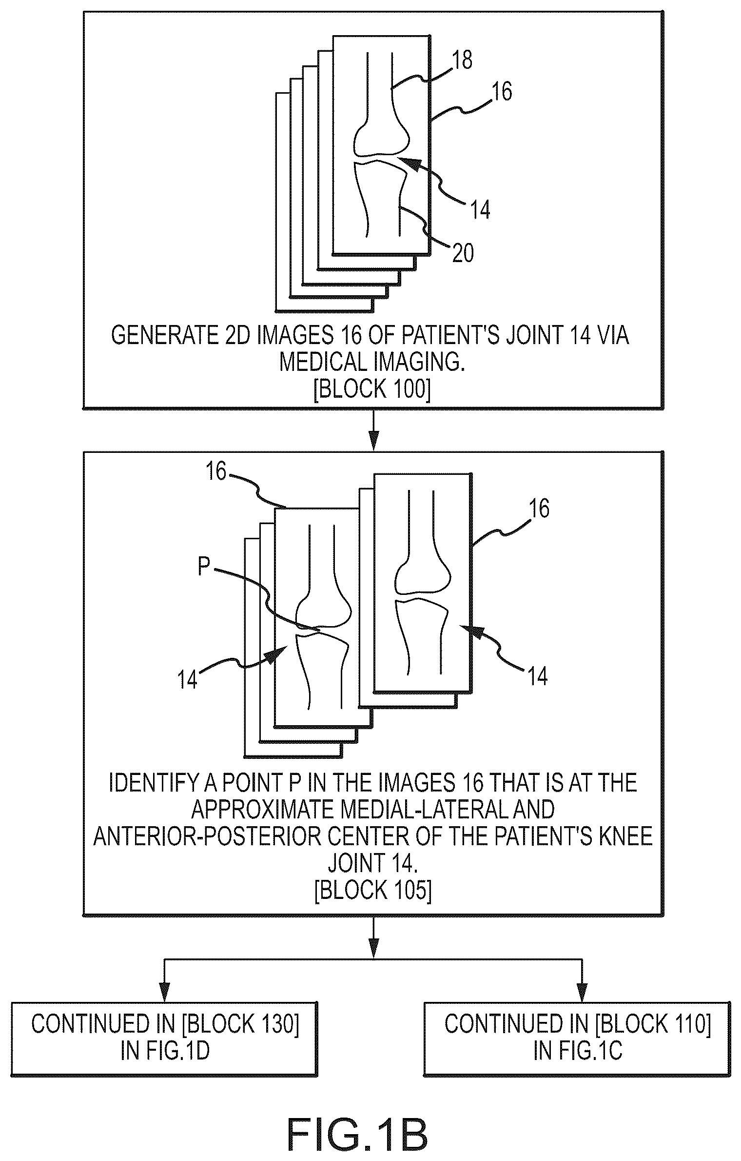 Patent US11847755 Figure 2 – System and method for image segmentation, bone model generation and modification, and surgical planning