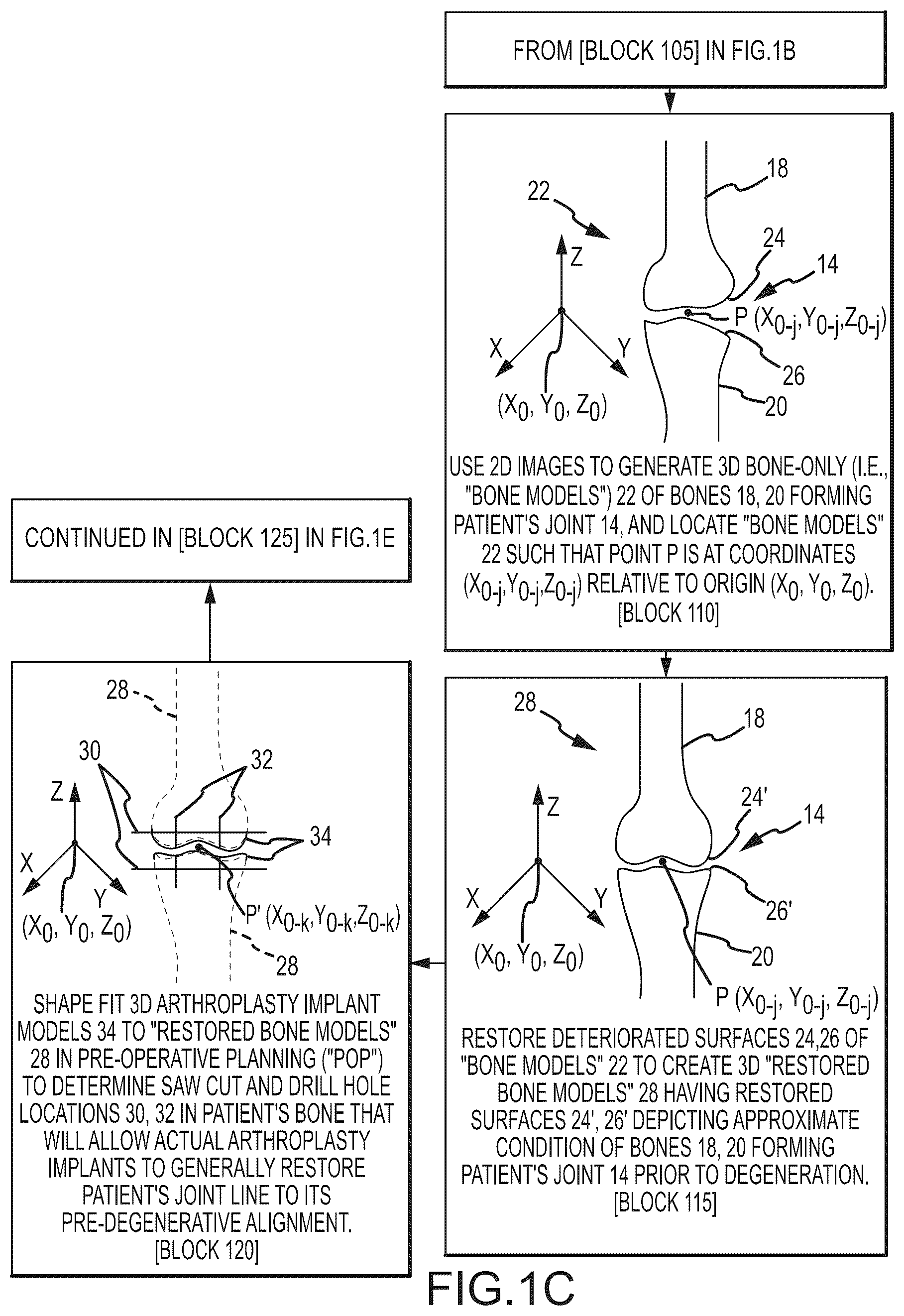 Patent US11847755 Figure 3 – System and method for image segmentation, bone model generation and modification, and surgical planning