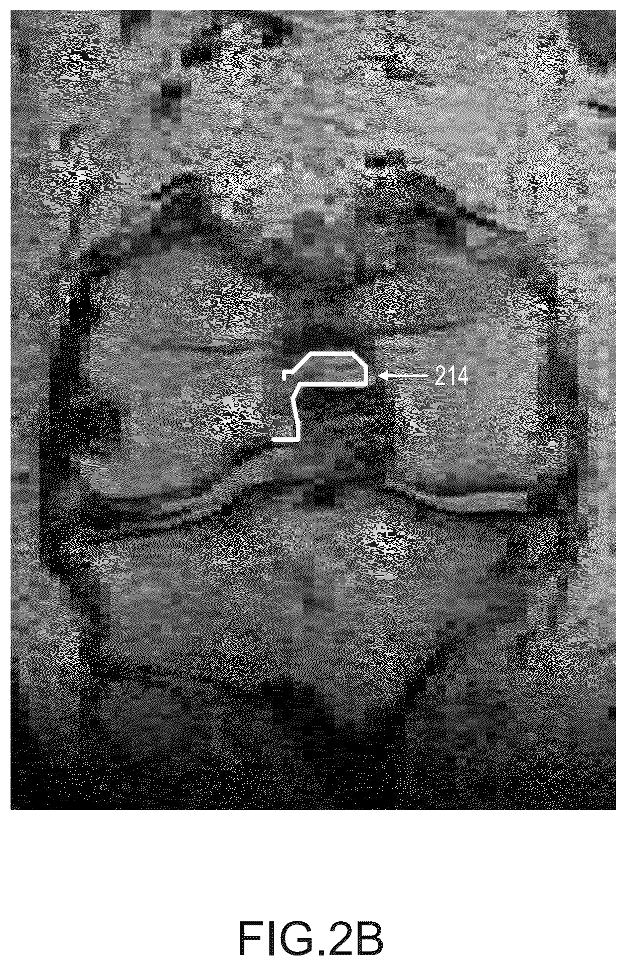Patent US11847755 Figure 9 – System and method for image segmentation, bone model generation and modification, and surgical planning