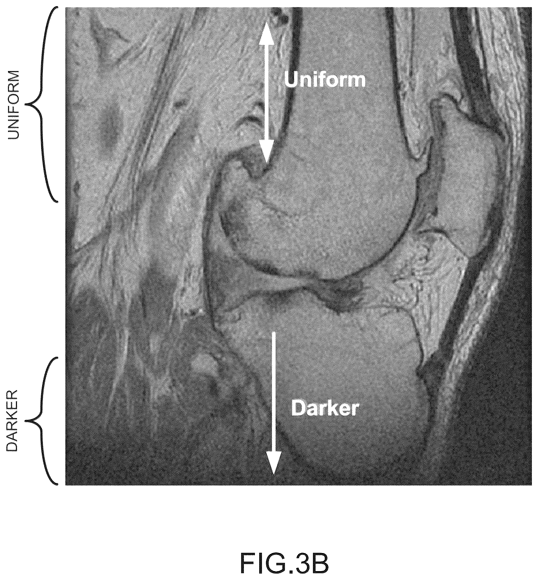 Patent US11847755 Figure 12 – System and method for image segmentation, bone model generation and modification, and surgical planning