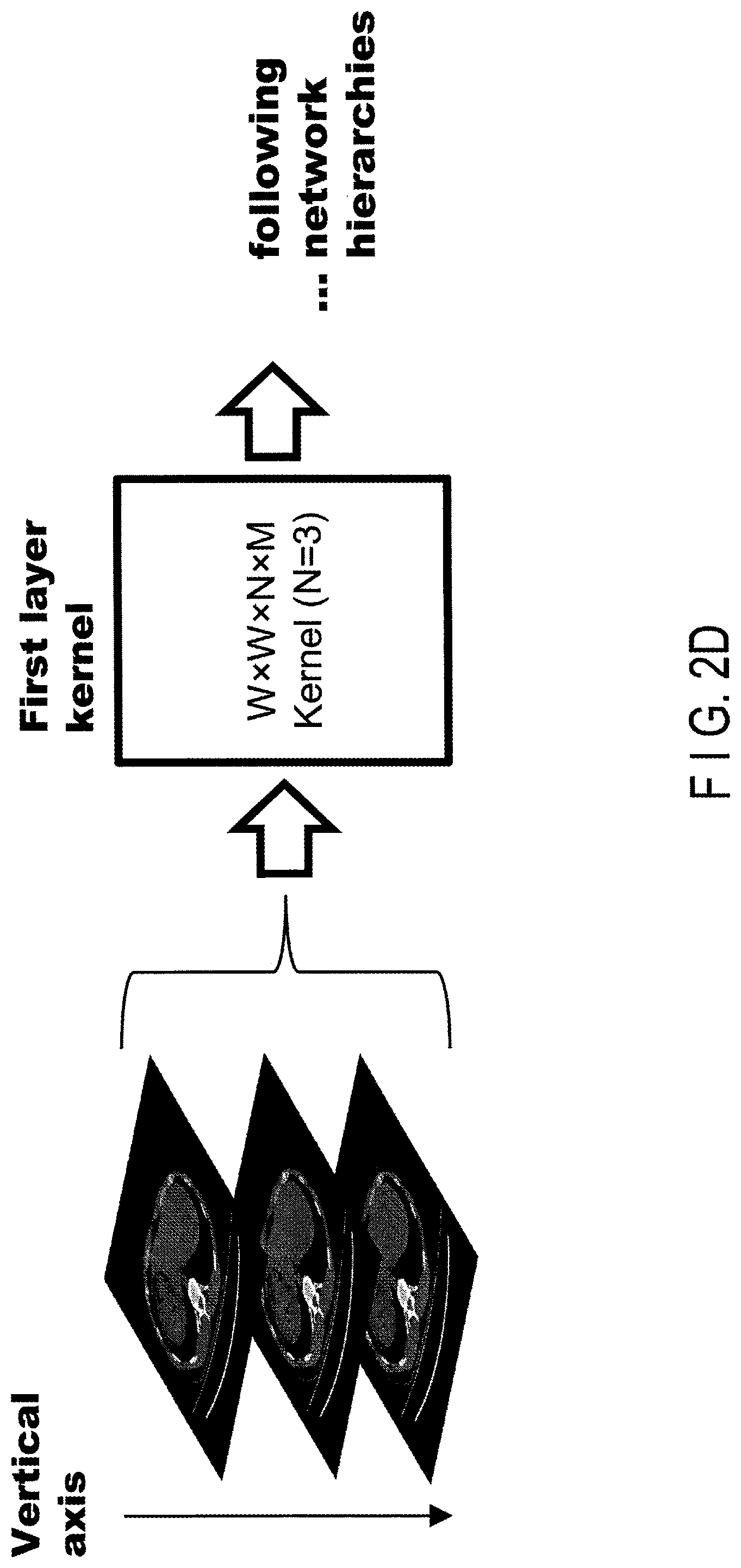 Patent US11847761 Figure 6 – Medical image processing apparatus having a plurality of neural networks corresponding to different fields of view