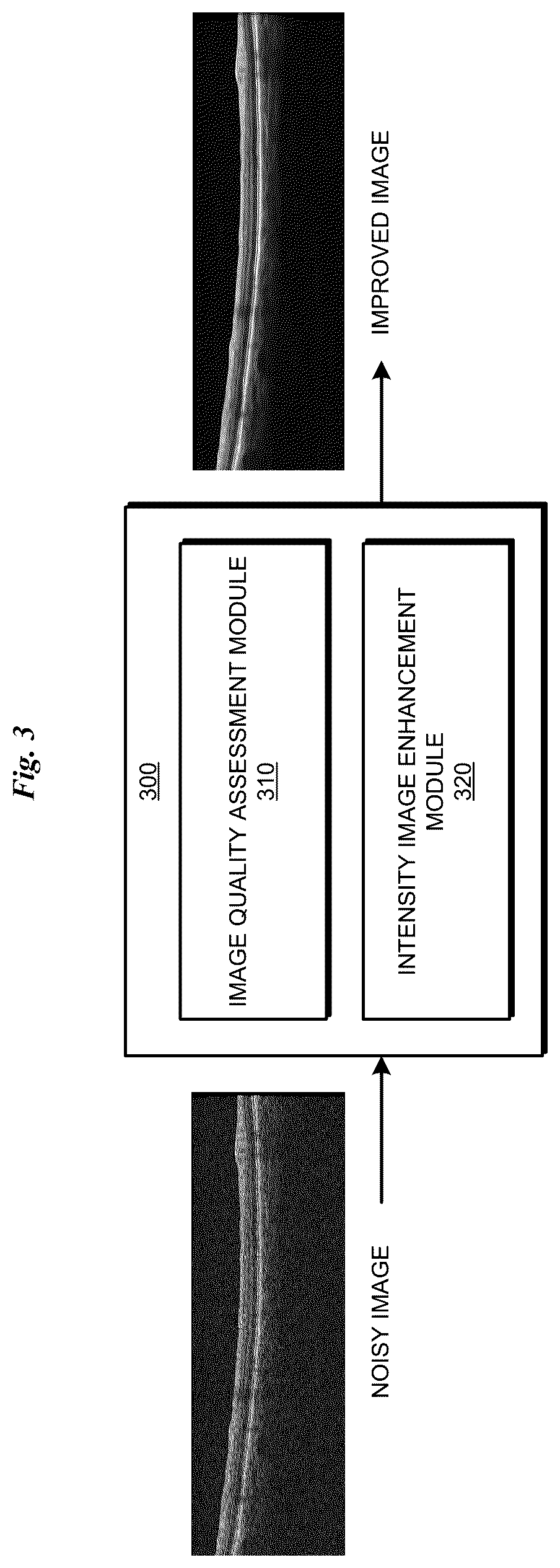 Patent US11847764 Figure 3 – Neural network based enhancement of intensity images
