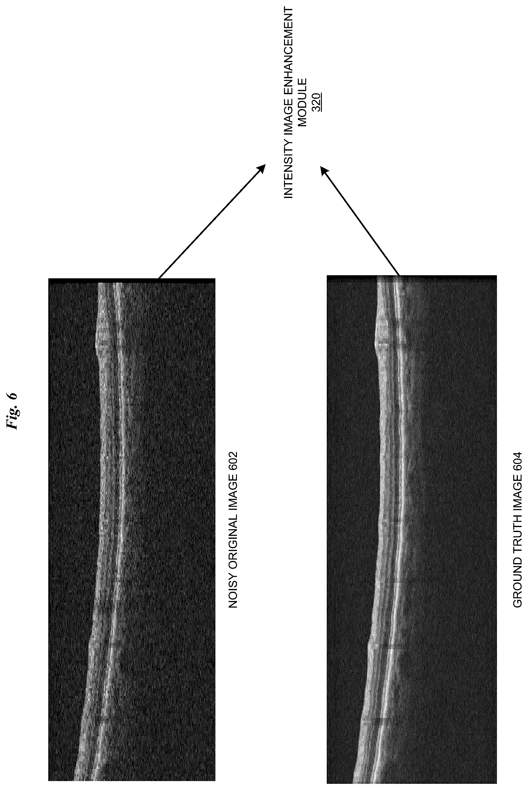 Patent US11847764 Figure 6 – Neural network based enhancement of intensity images