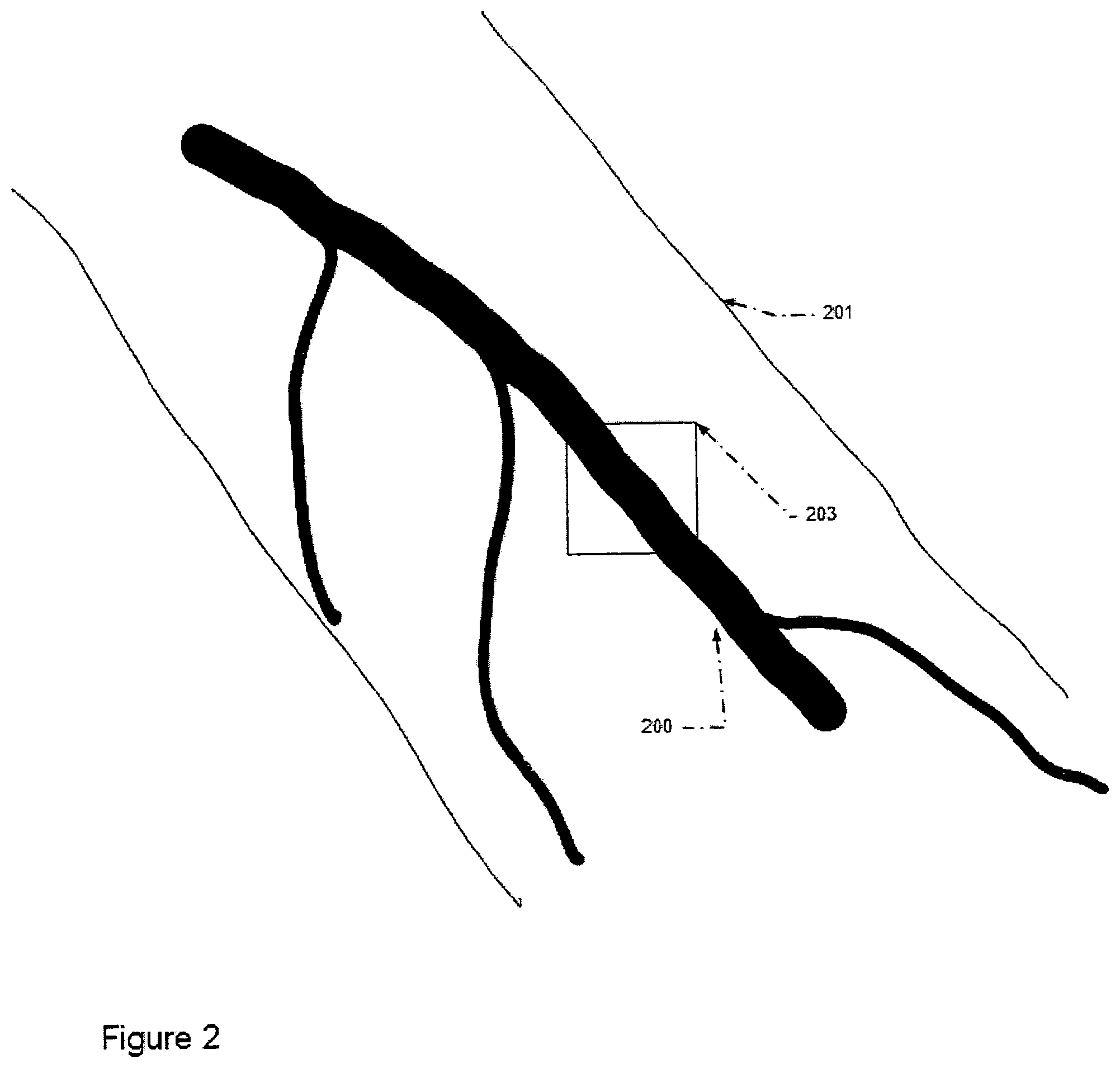 Patent US11847768 Figure 2 – Automatic alignment of a contrast enhancement system