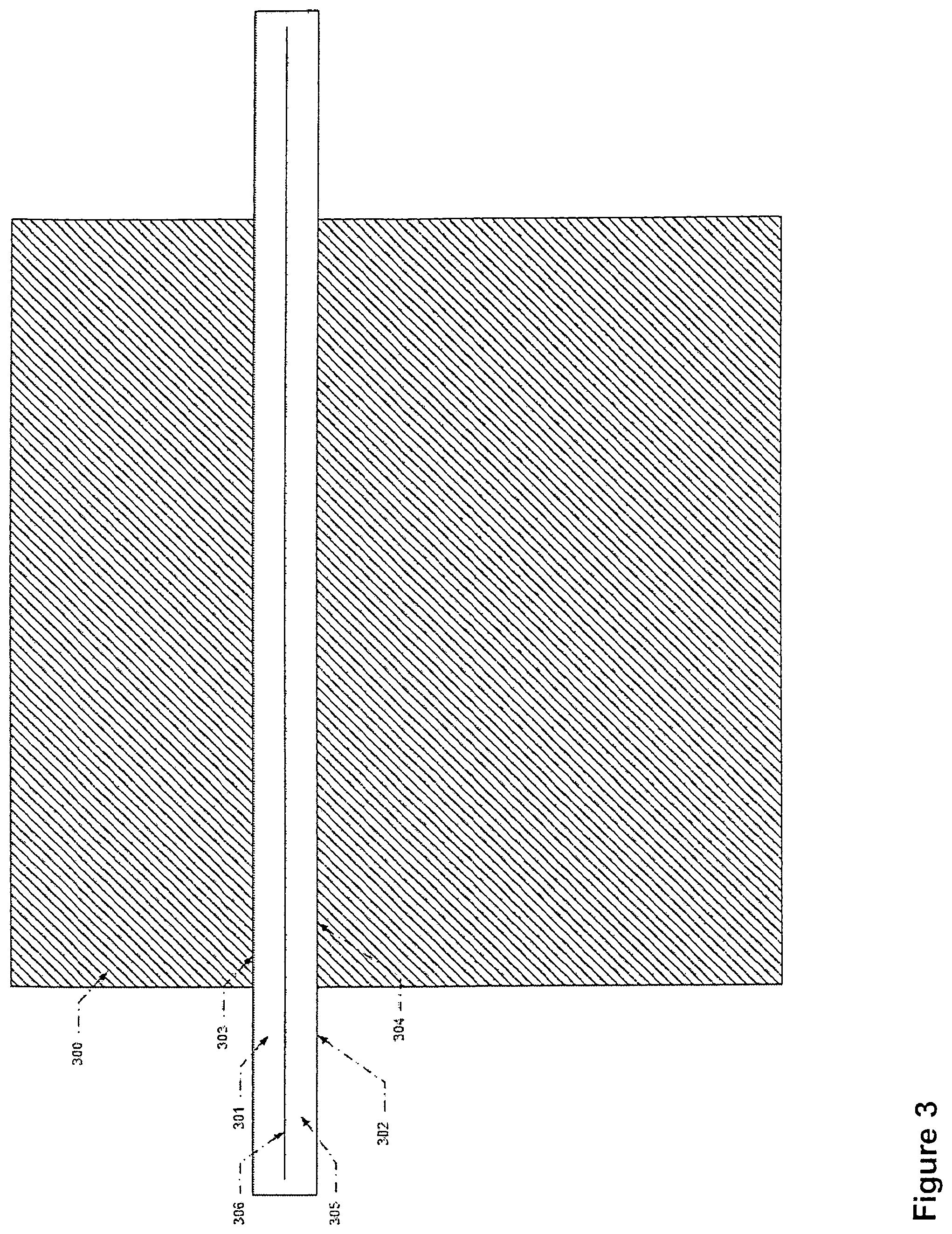 Patent US11847768 Figure 3 – Automatic alignment of a contrast enhancement system