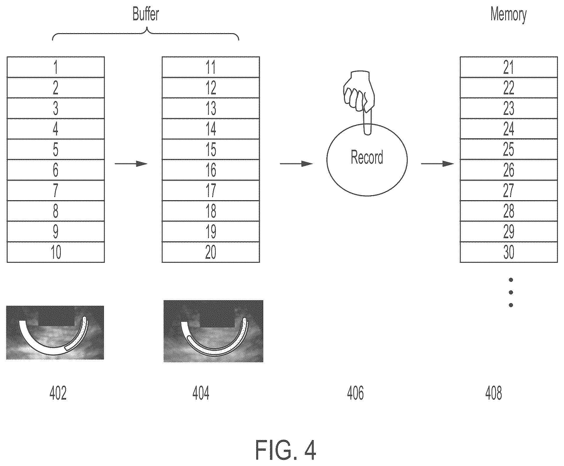 Patent US11847772 Figure 4 – Quality indicators for collection of and automated measurement on ultrasound images