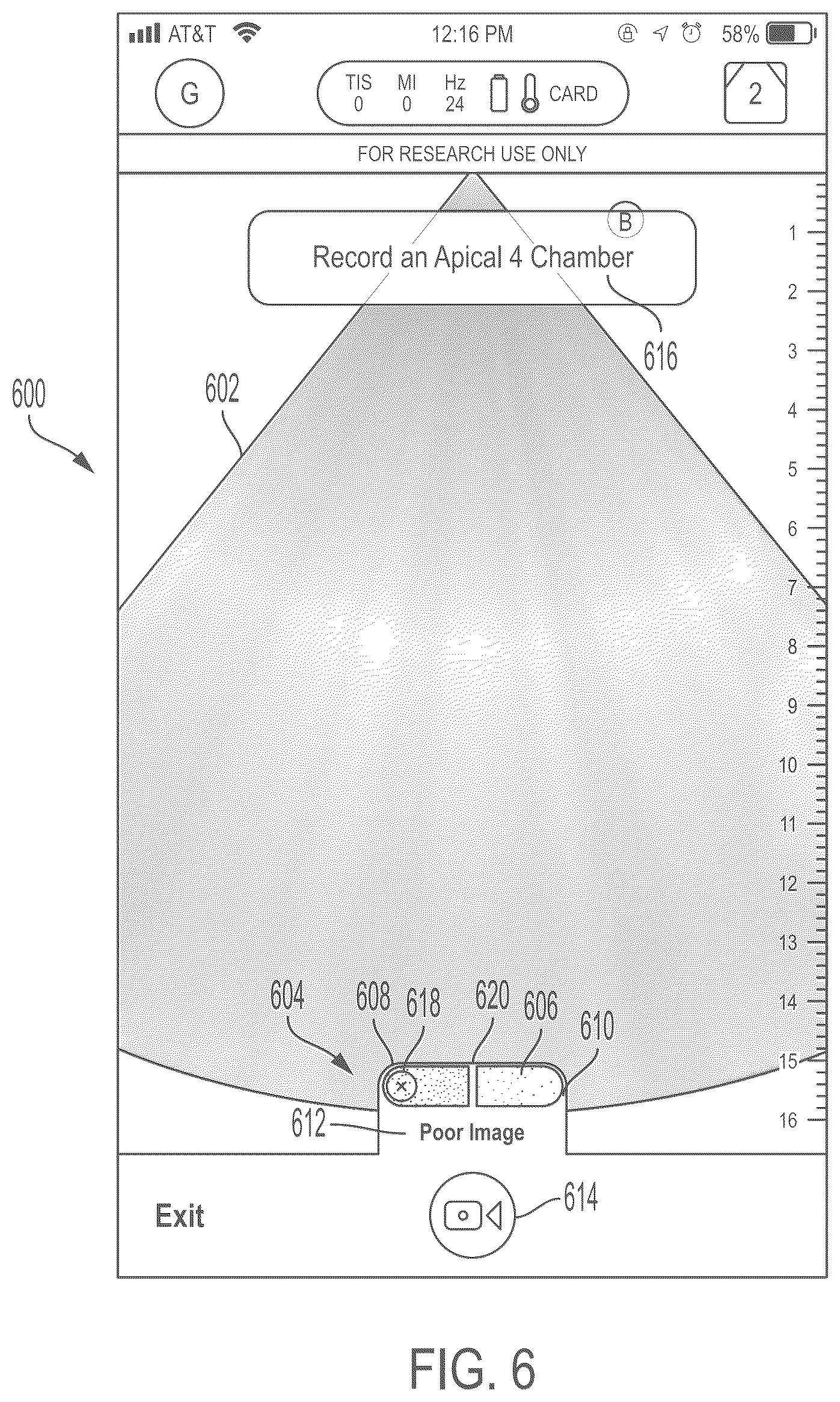 Patent US11847772 Figure 6 – Quality indicators for collection of and automated measurement on ultrasound images