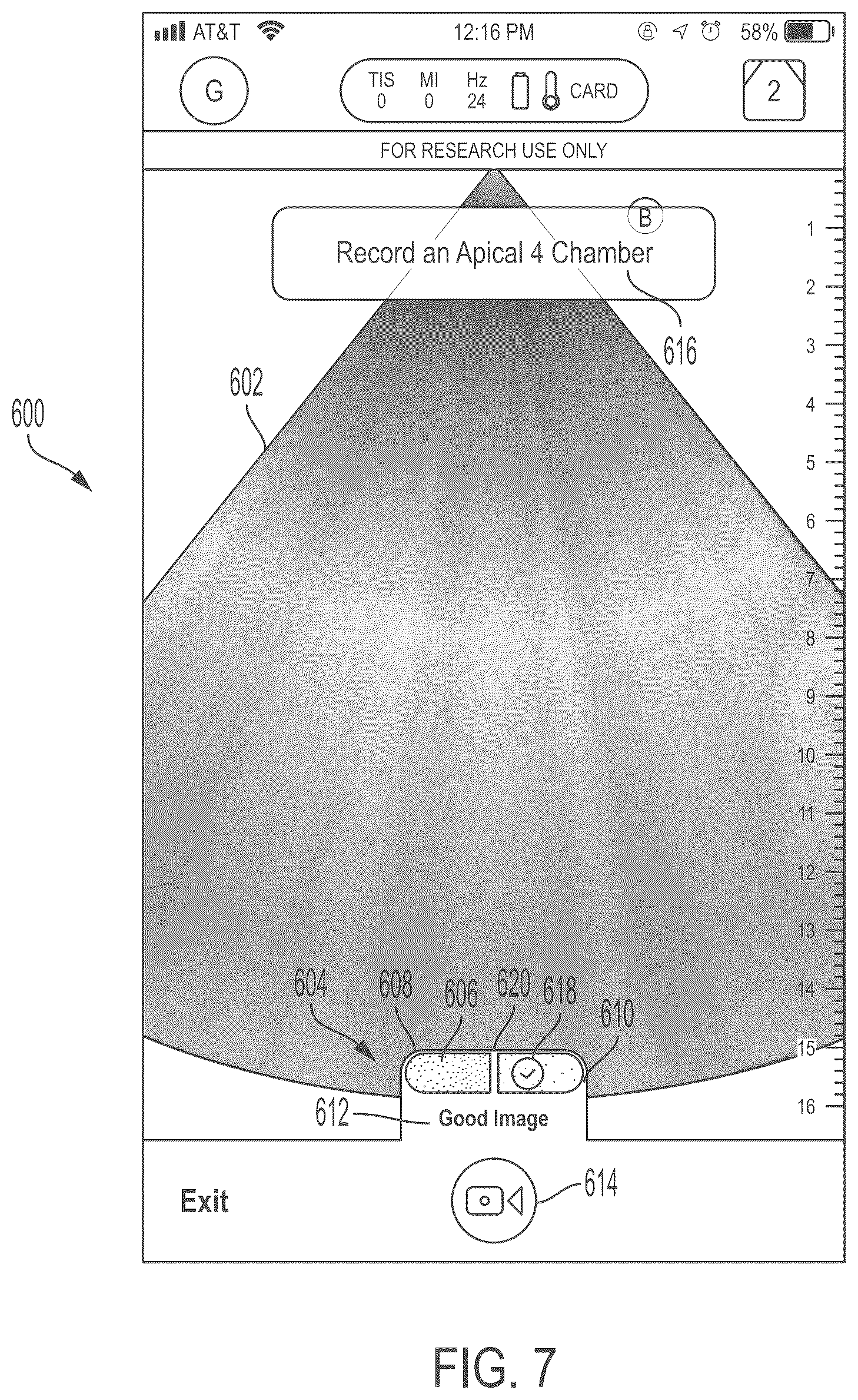 Patent US11847772 Figure 7 – Quality indicators for collection of and automated measurement on ultrasound images