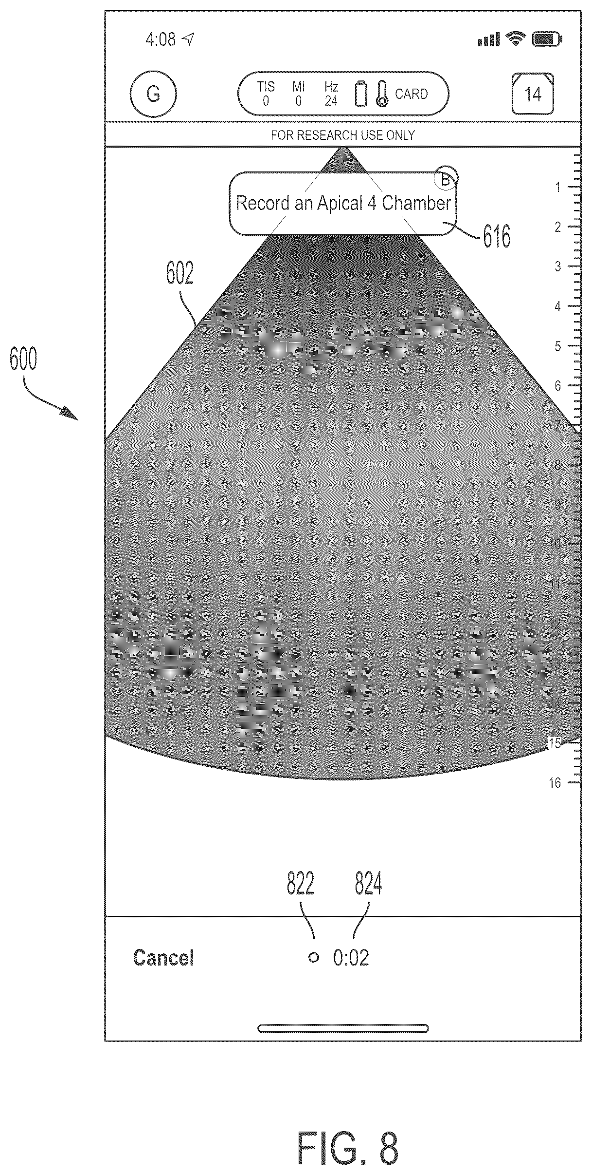 Patent US11847772 Figure 8 – Quality indicators for collection of and automated measurement on ultrasound images