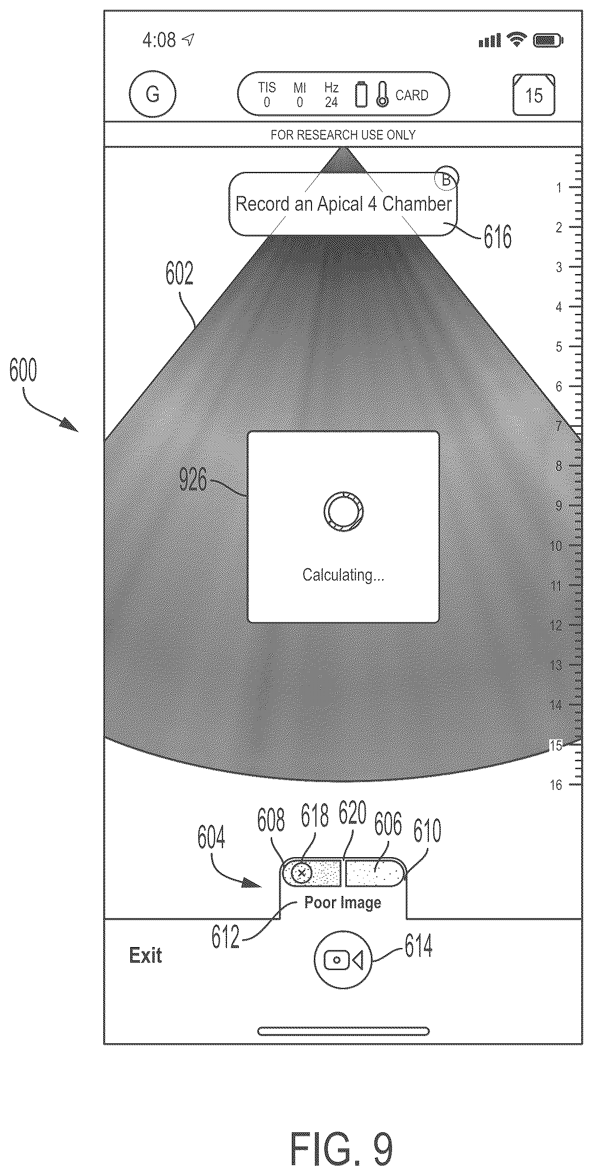 Patent US11847772 Figure 9 – Quality indicators for collection of and automated measurement on ultrasound images