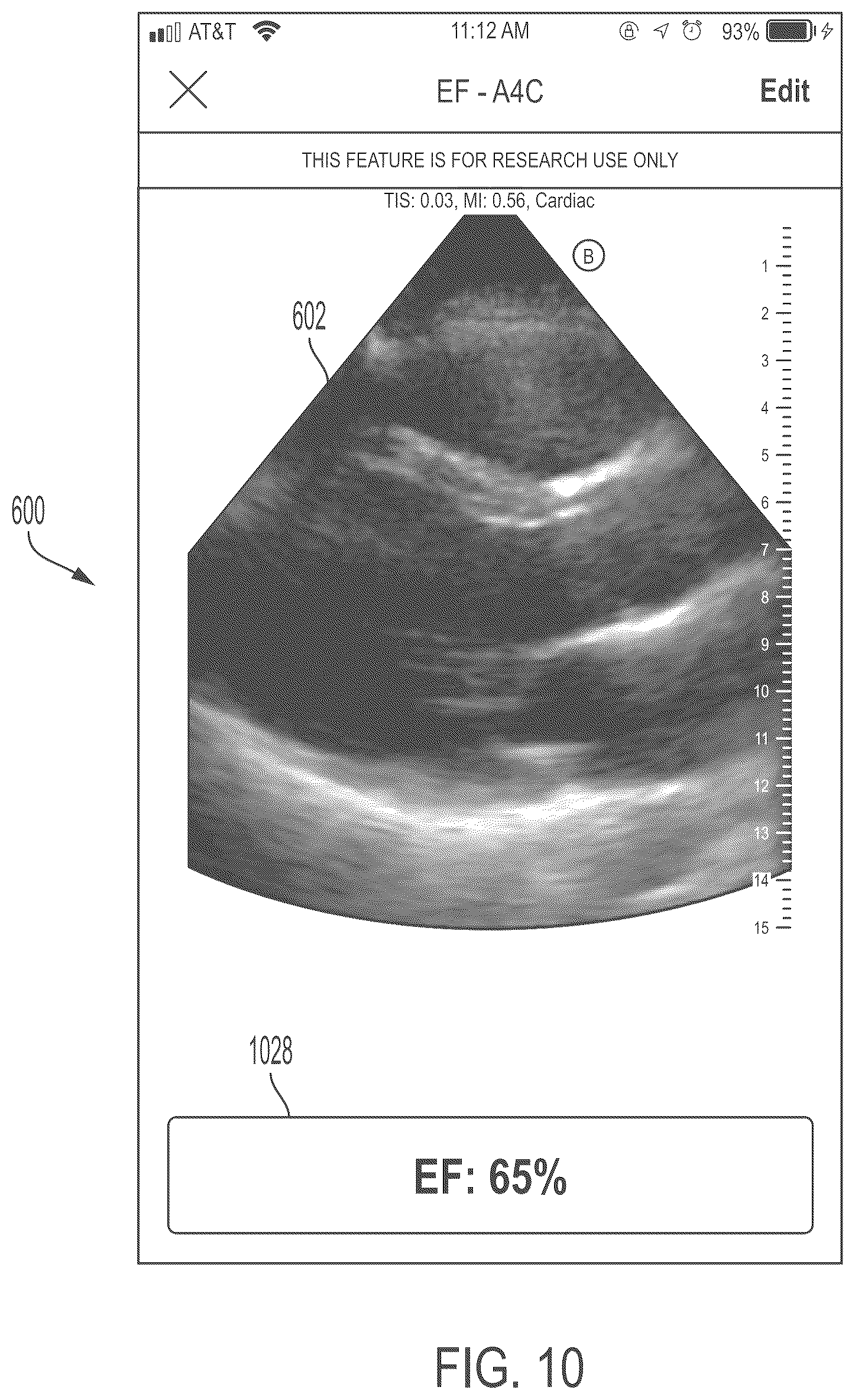 Patent US11847772 Figure 10 – Quality indicators for collection of and automated measurement on ultrasound images
