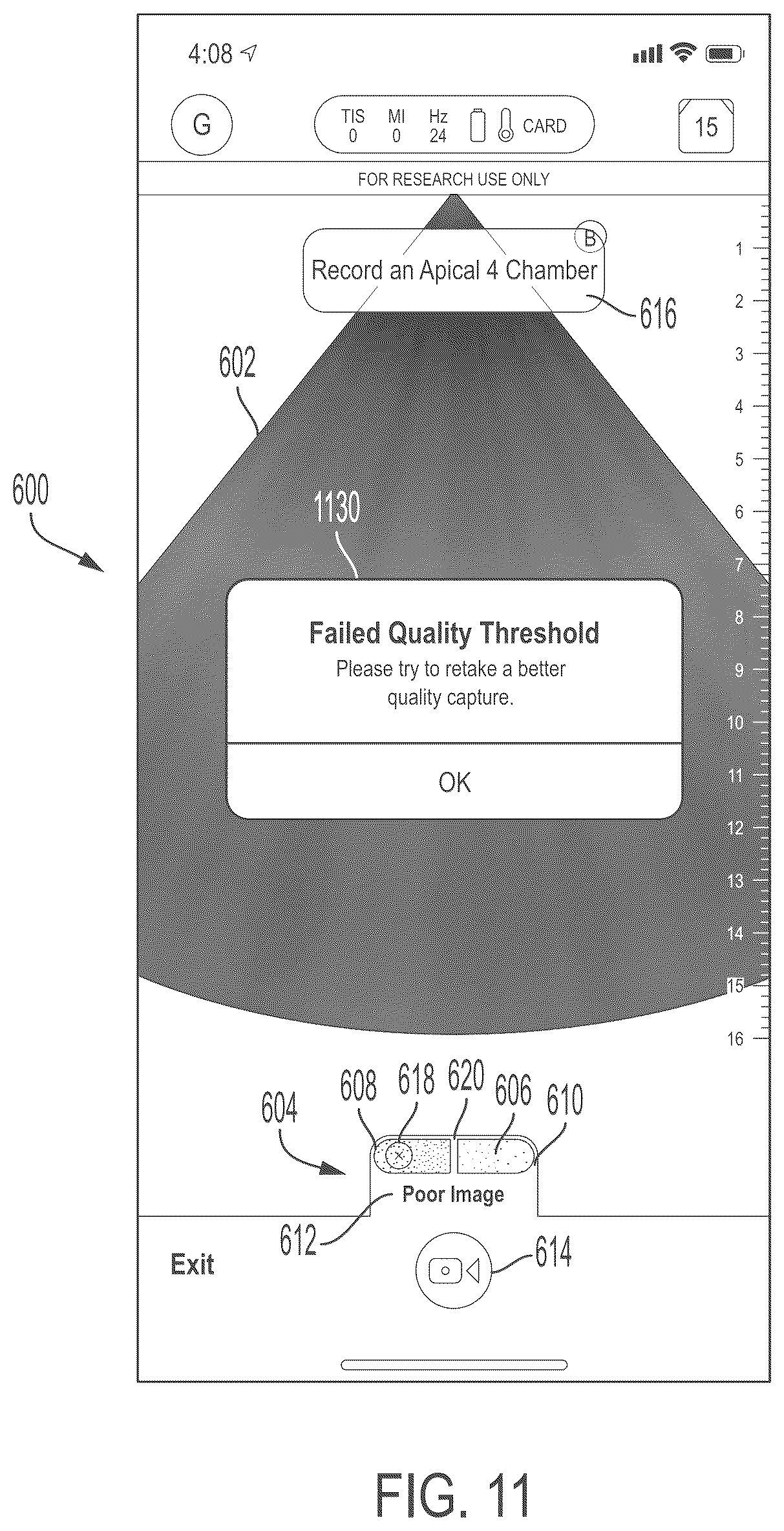 Patent US11847772 Figure 11 – Quality indicators for collection of and automated measurement on ultrasound images