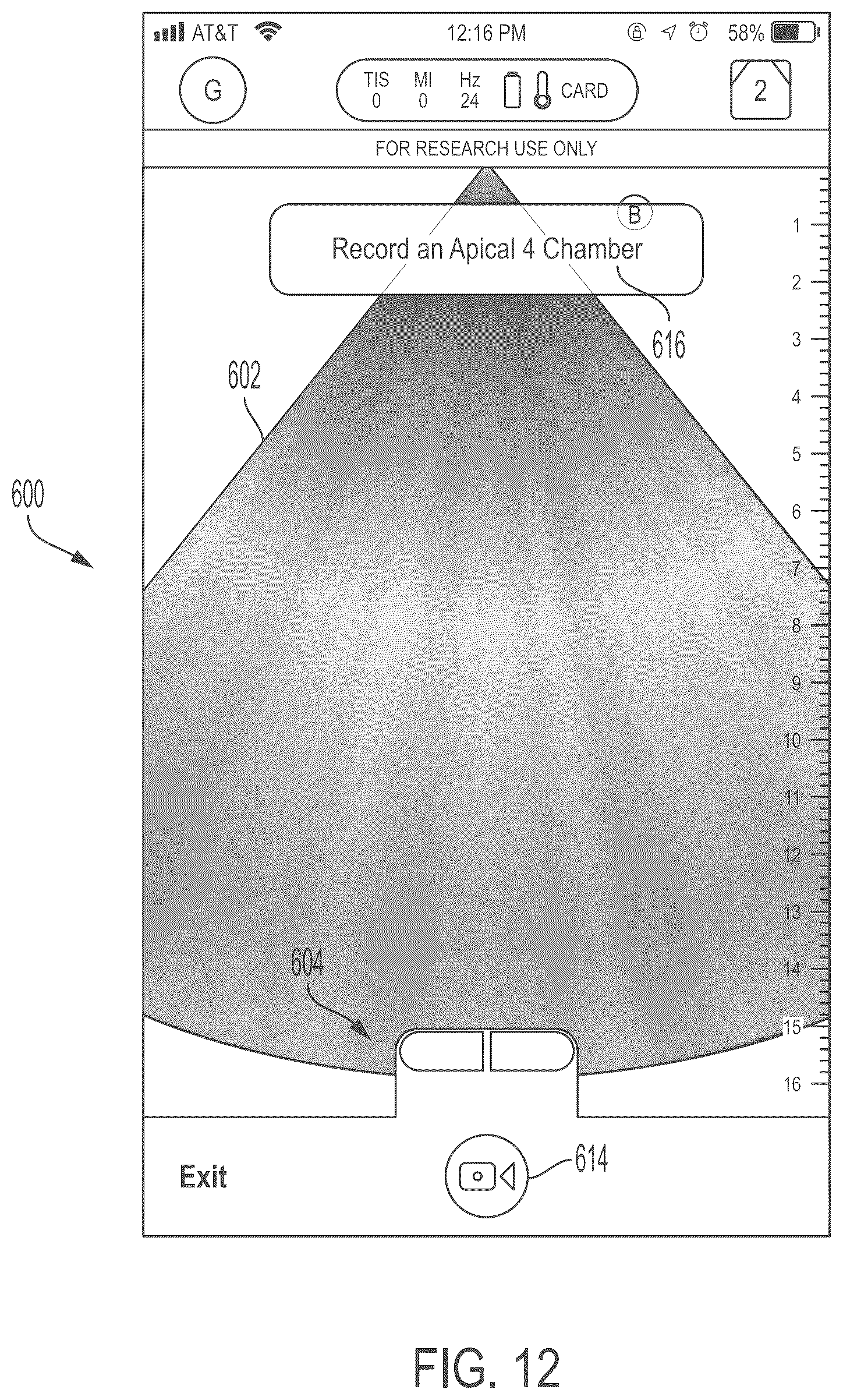 Patent US11847772 Figure 12 – Quality indicators for collection of and automated measurement on ultrasound images