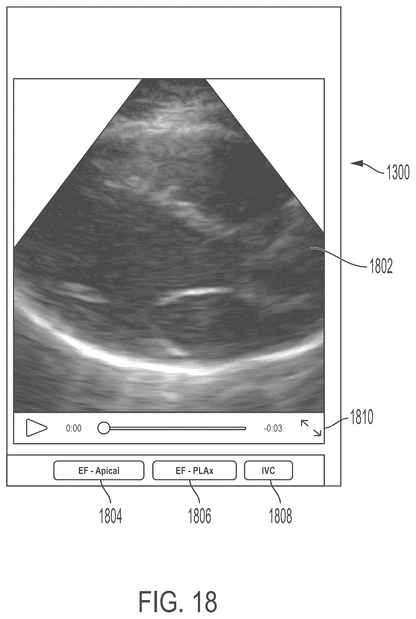 Patent US11847772 Figure 18 – Quality indicators for collection of and automated measurement on ultrasound images