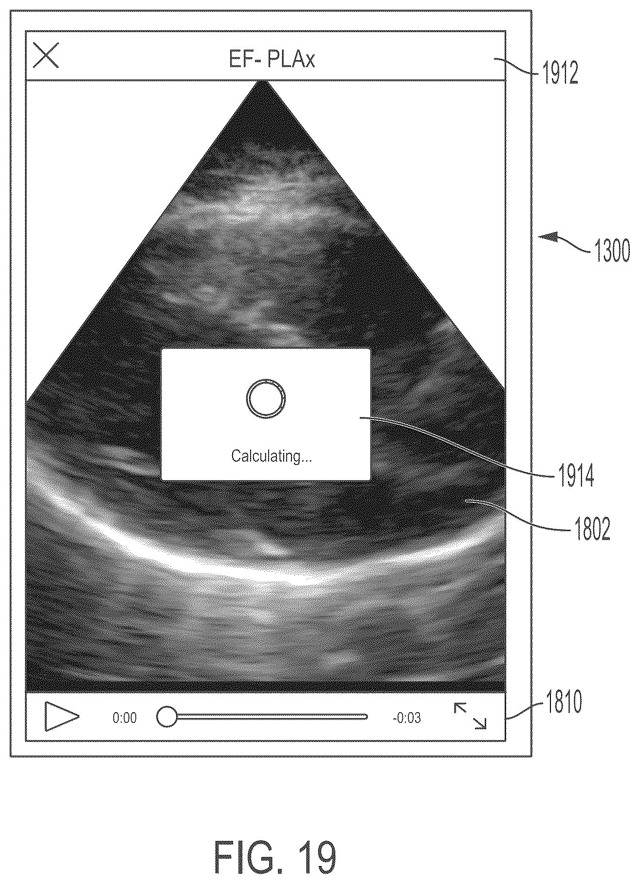 Patent US11847772 Figure 19 – Quality indicators for collection of and automated measurement on ultrasound images