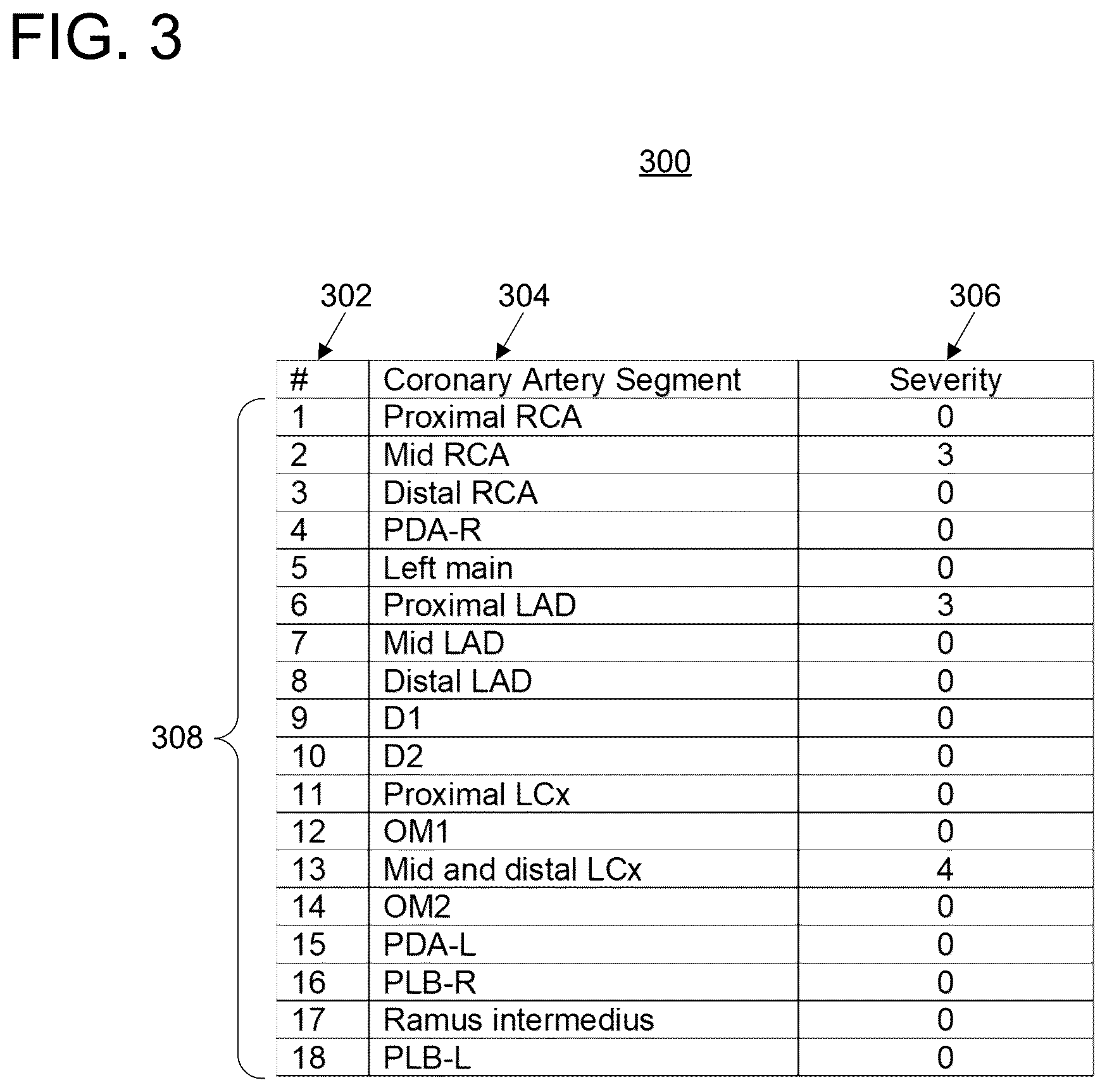Patent US11847779 Figure 3 – Clinical decision support for cardiovascular disease based on a plurality of medical assessments