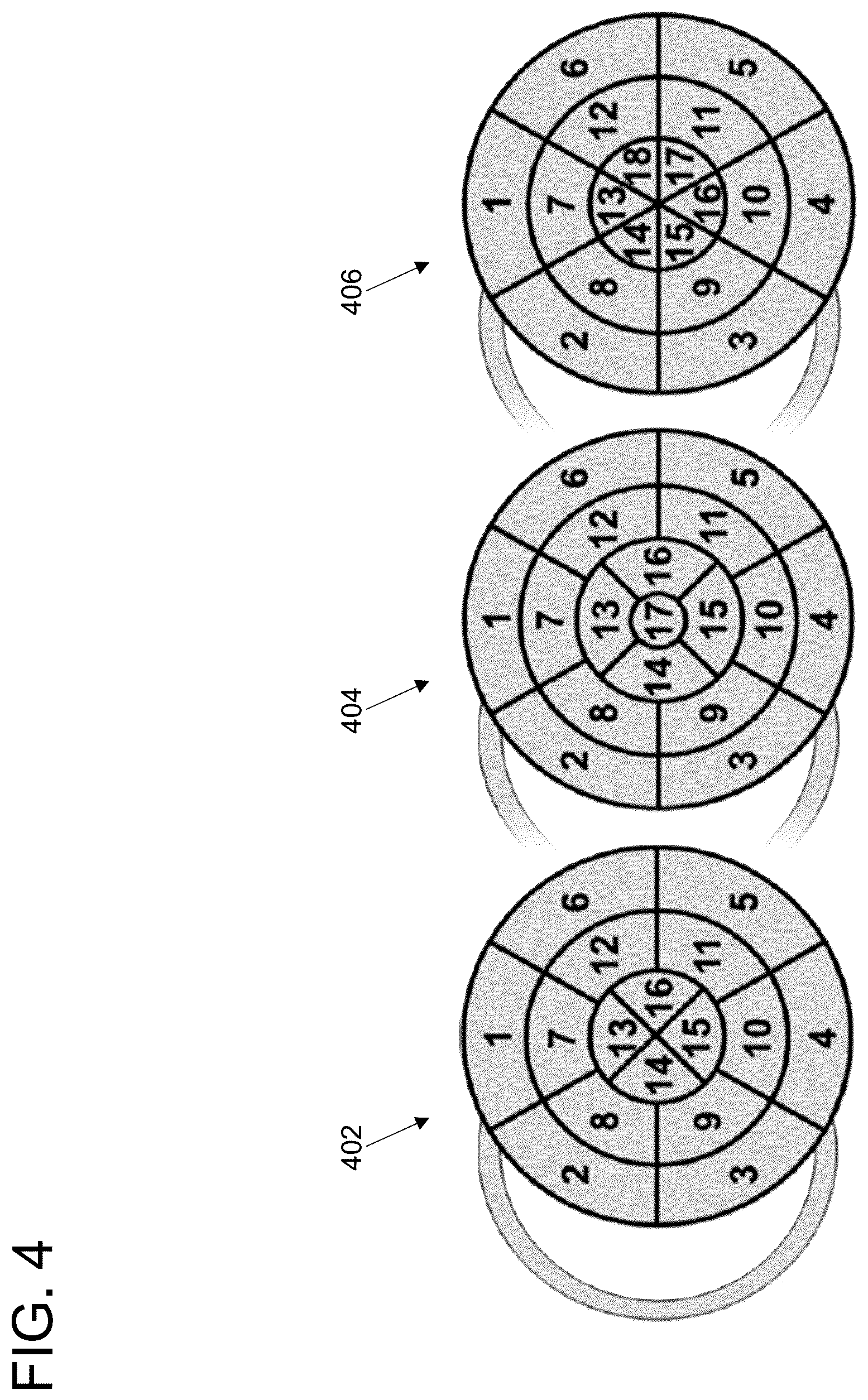 Patent US11847779 Figure 4 – Clinical decision support for cardiovascular disease based on a plurality of medical assessments