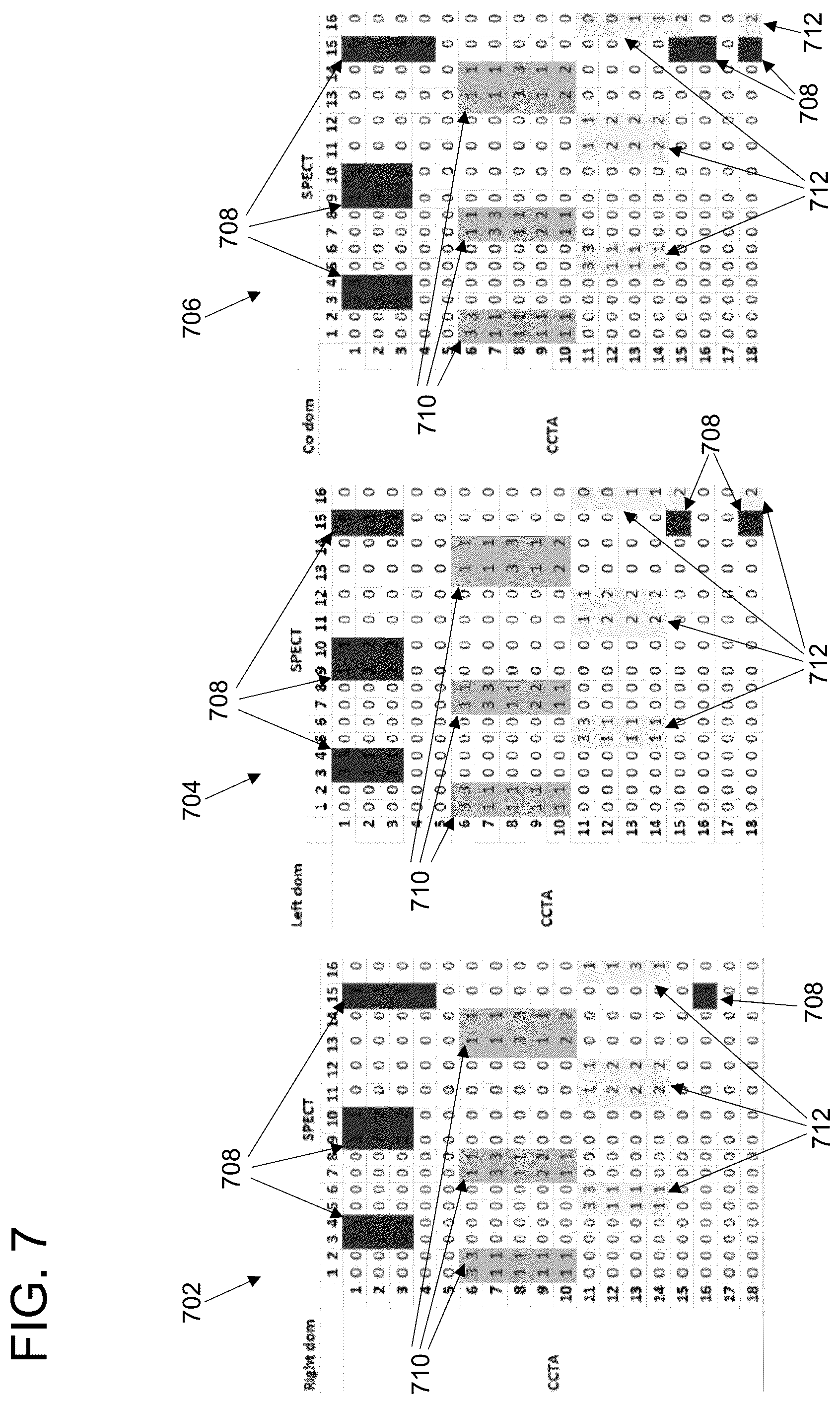 Patent US11847779 Figure 7 – Clinical decision support for cardiovascular disease based on a plurality of medical assessments