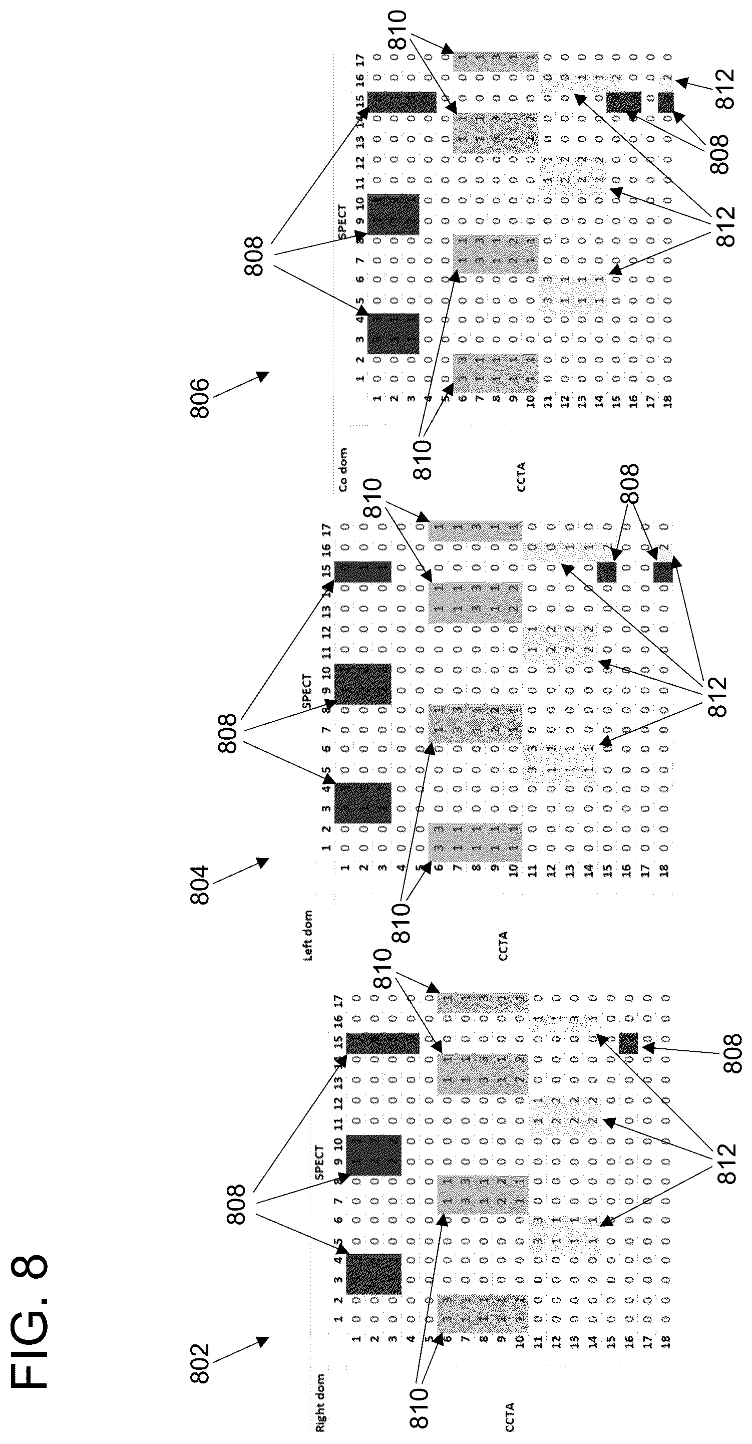 Patent US11847779 Figure 8 – Clinical decision support for cardiovascular disease based on a plurality of medical assessments