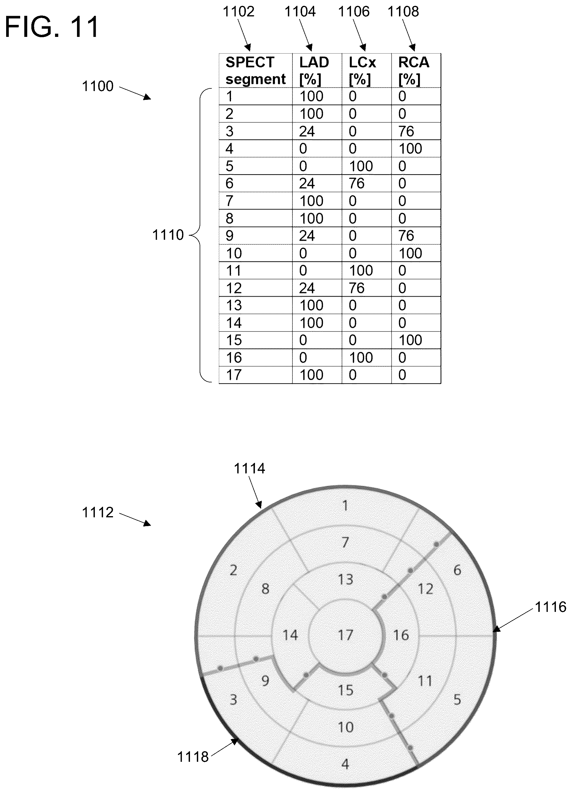 Patent US11847779 Figure 11 – Clinical decision support for cardiovascular disease based on a plurality of medical assessments