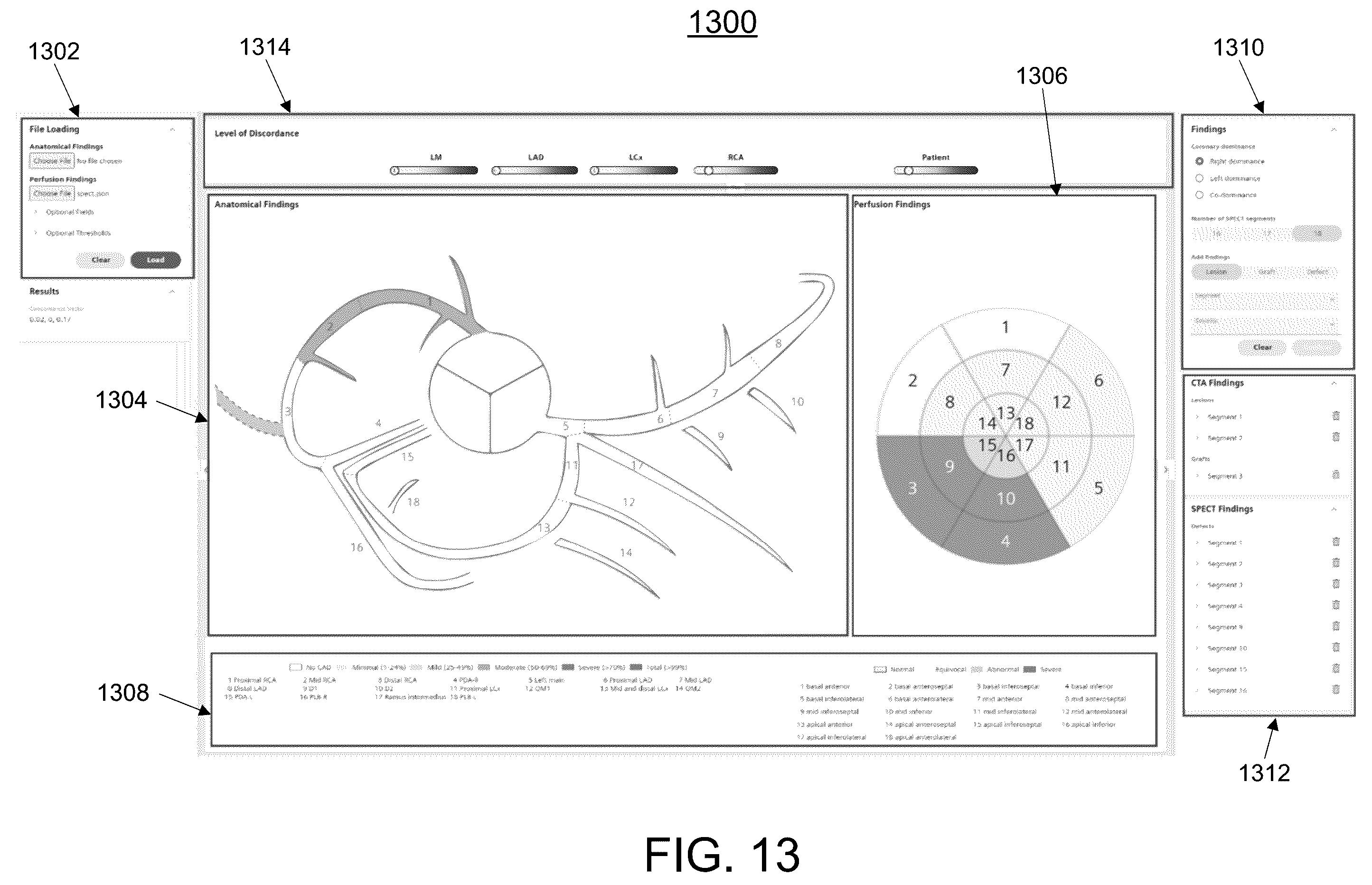Patent US11847779 Figure 13 – Clinical decision support for cardiovascular disease based on a plurality of medical assessments