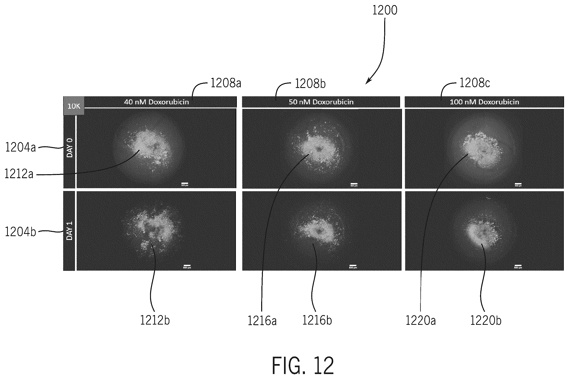 Patent US11847780 Figure 12 – Treatment efficacy prediction systems and methods