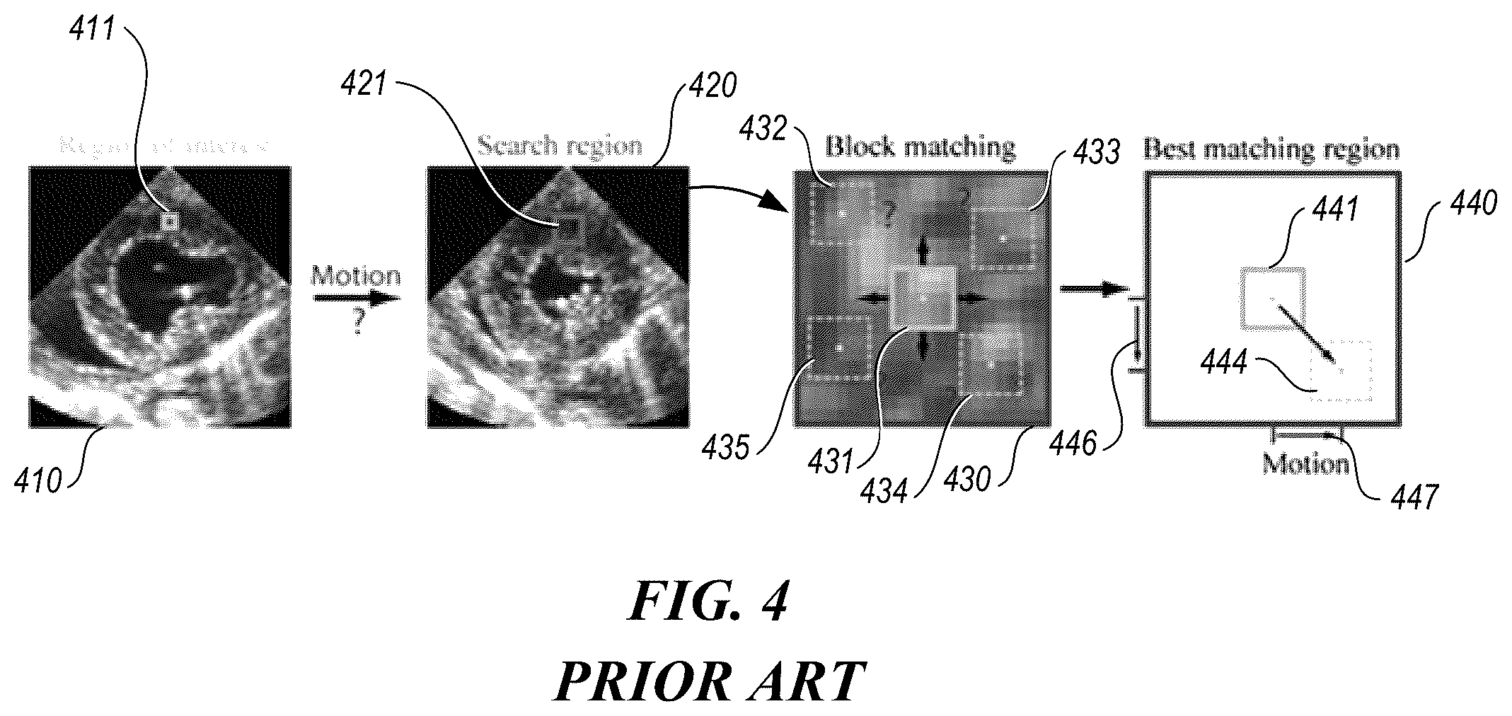 Patent US11847786 Figure 3 – Motion learning without labels